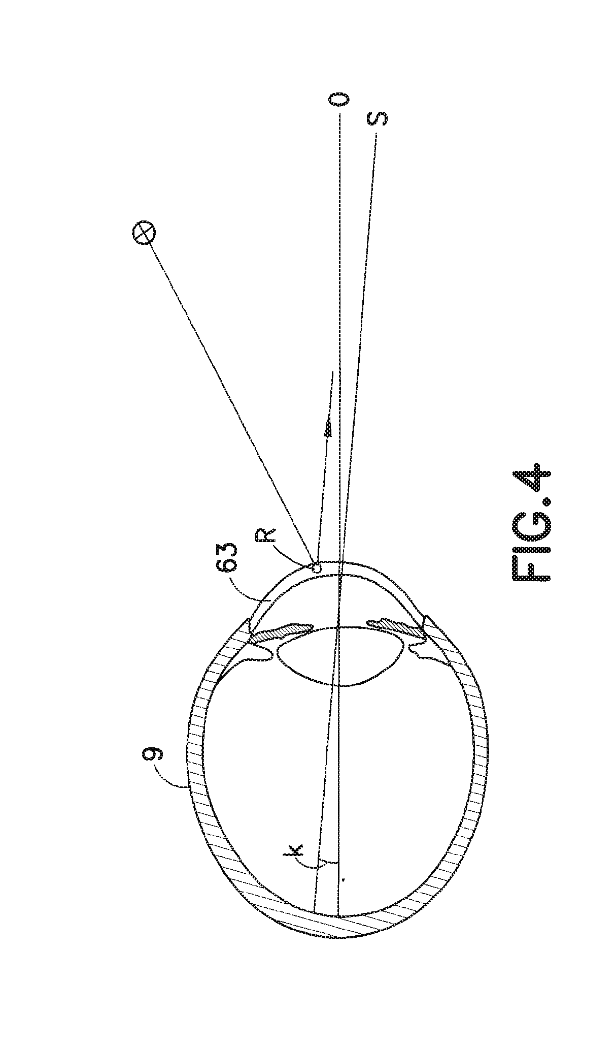 Measurement system and method for establishing the refraction of an eye, the radius of curvature of the cornea or the internal pressure of an eye