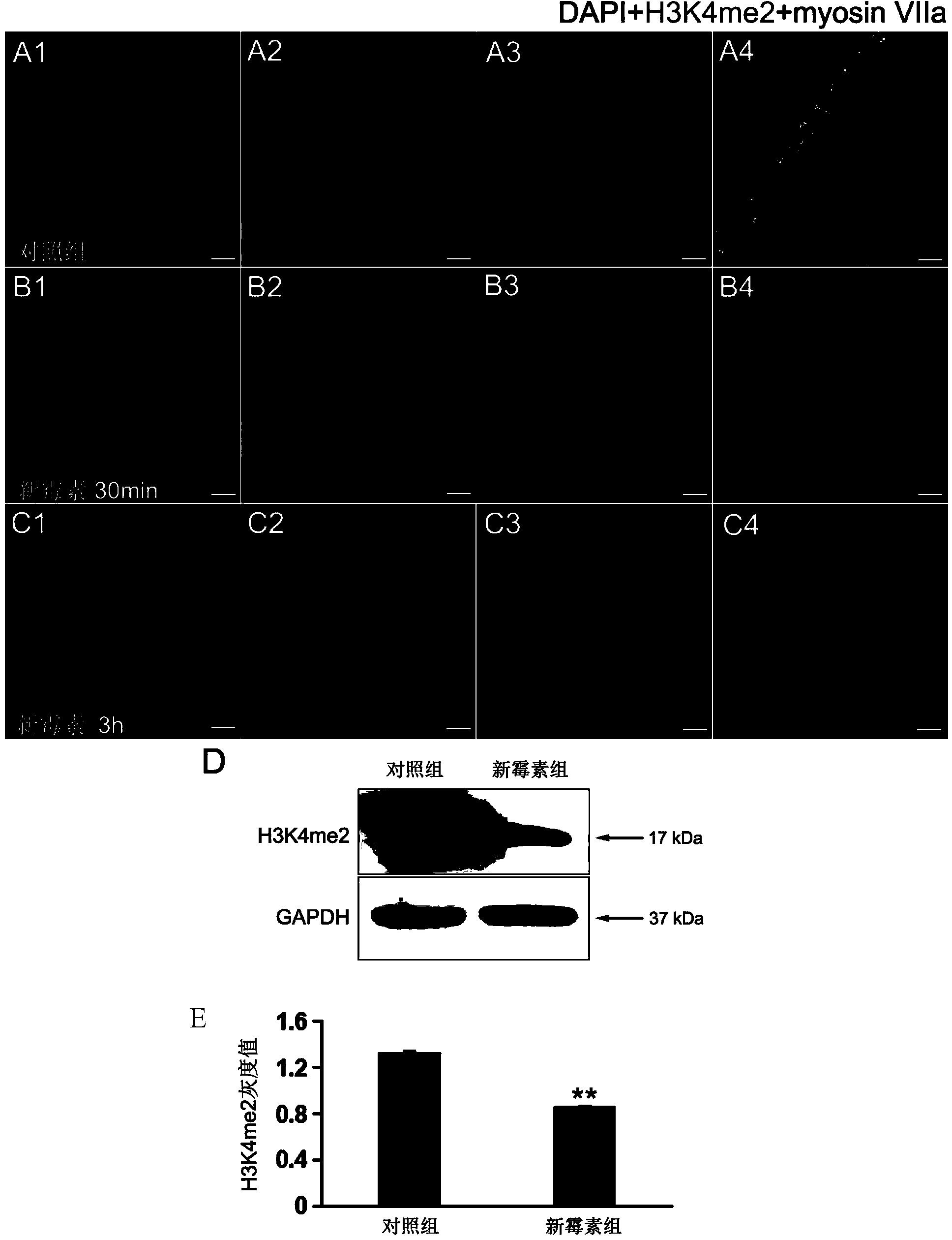 Use of lysine-specific demethylase 1 (LSD1) inhibitor