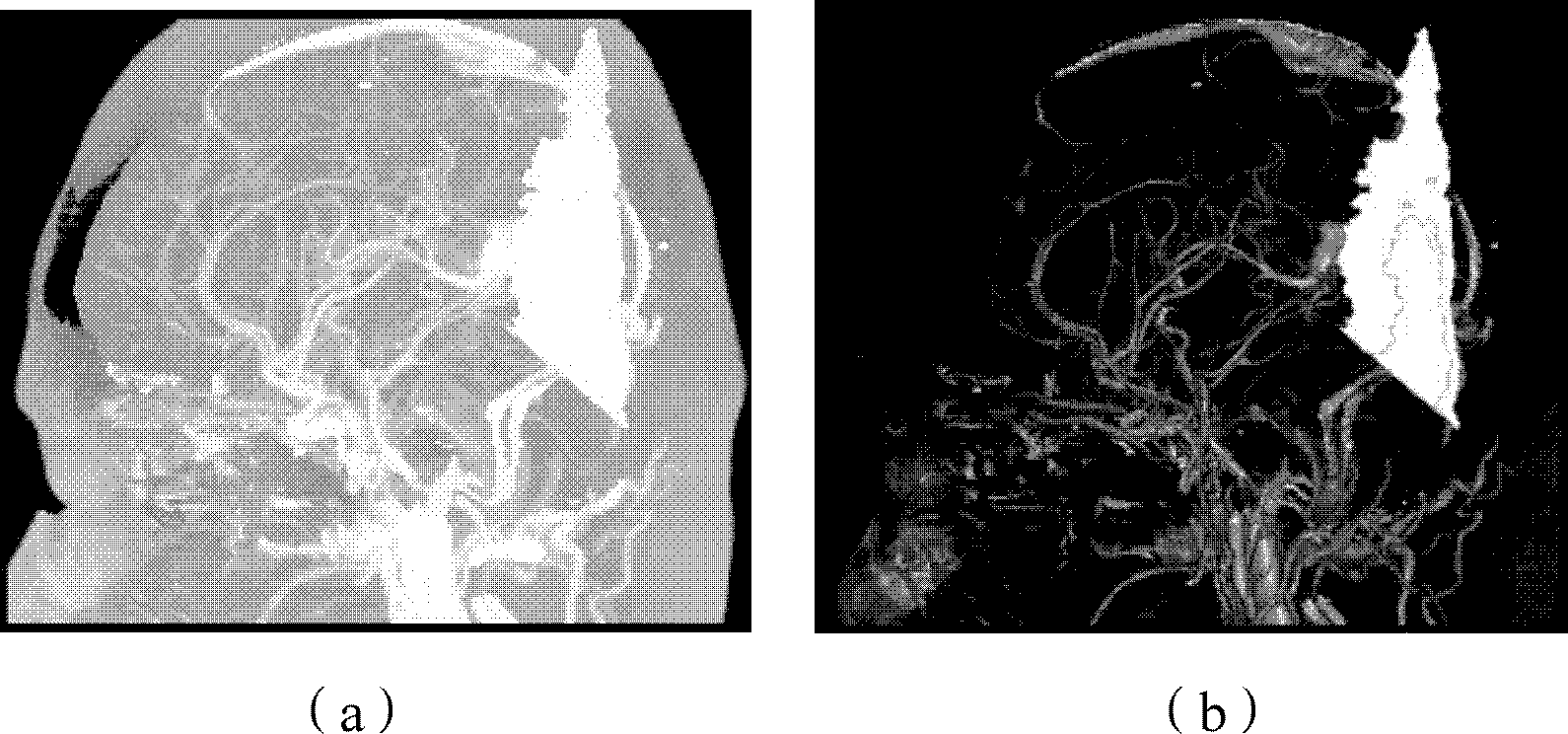 Method and device for removing scanning table from CTA (Computed Tomography Angiography) image