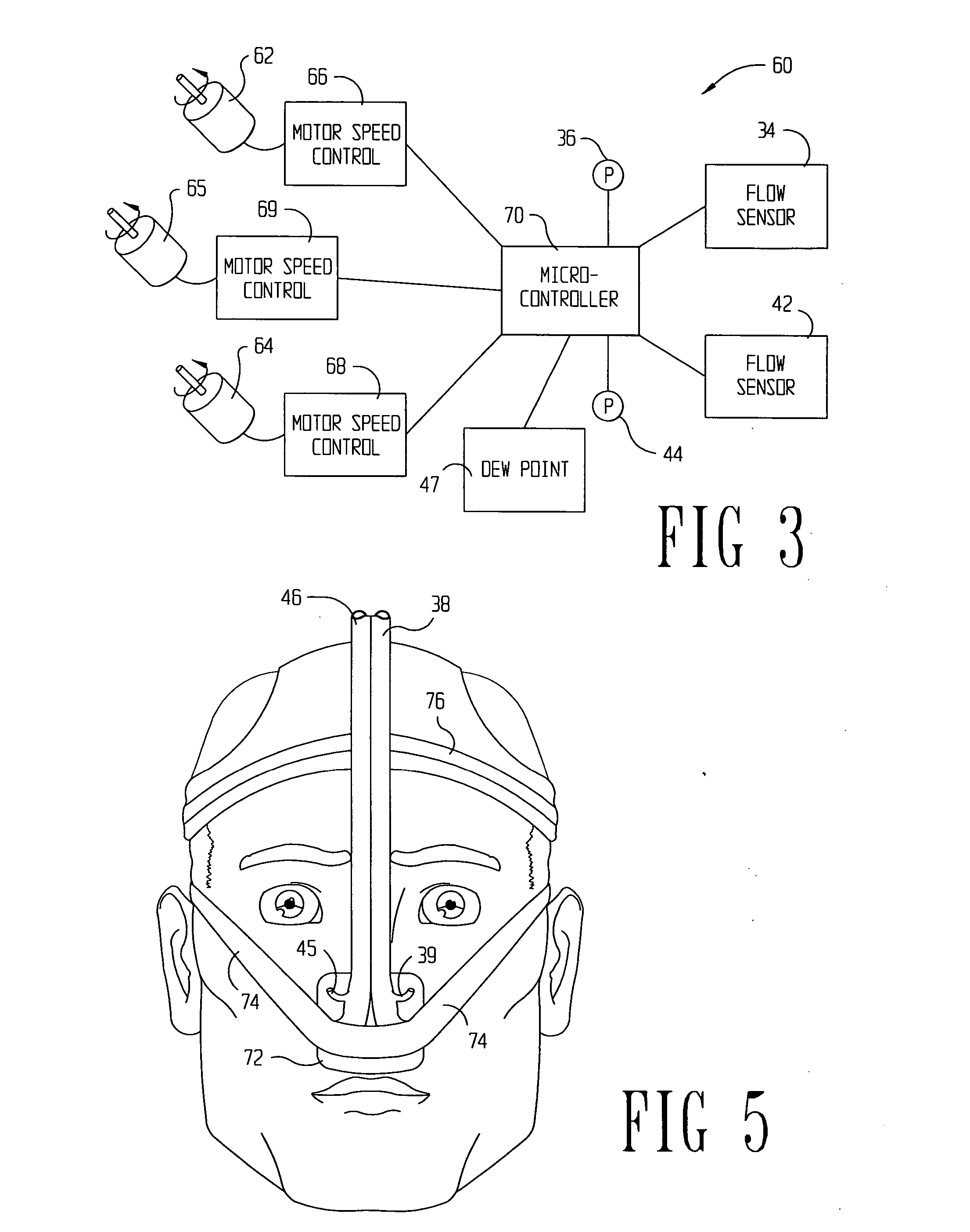 Method and system of Individually controlling airway pressure of a patient's nares