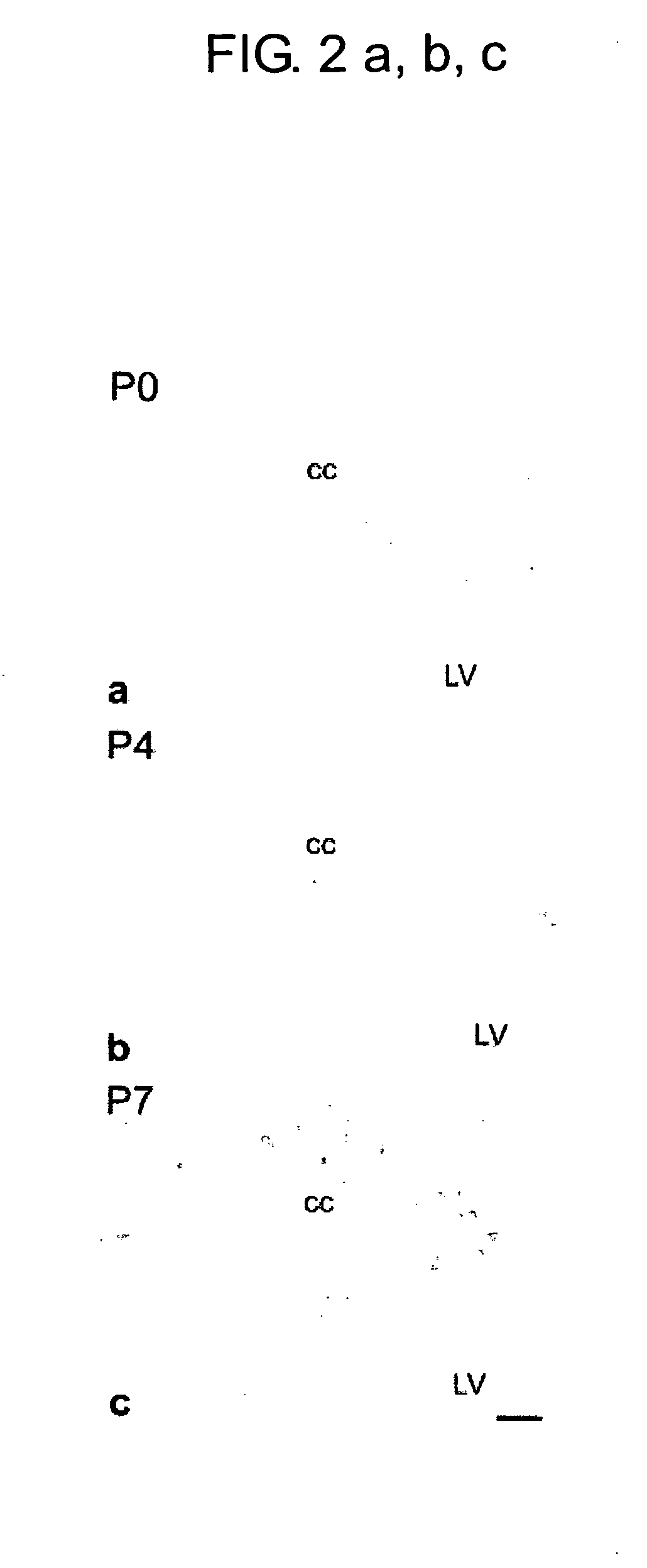 Medicinal compositions containing fc receptor gamma-chain activator