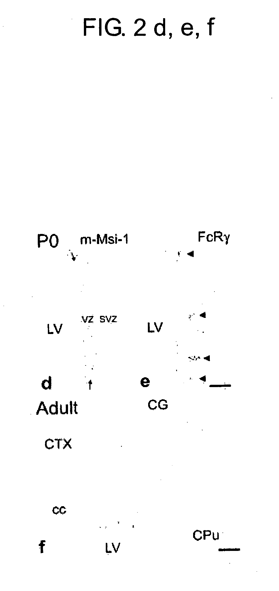Medicinal compositions containing fc receptor gamma-chain activator