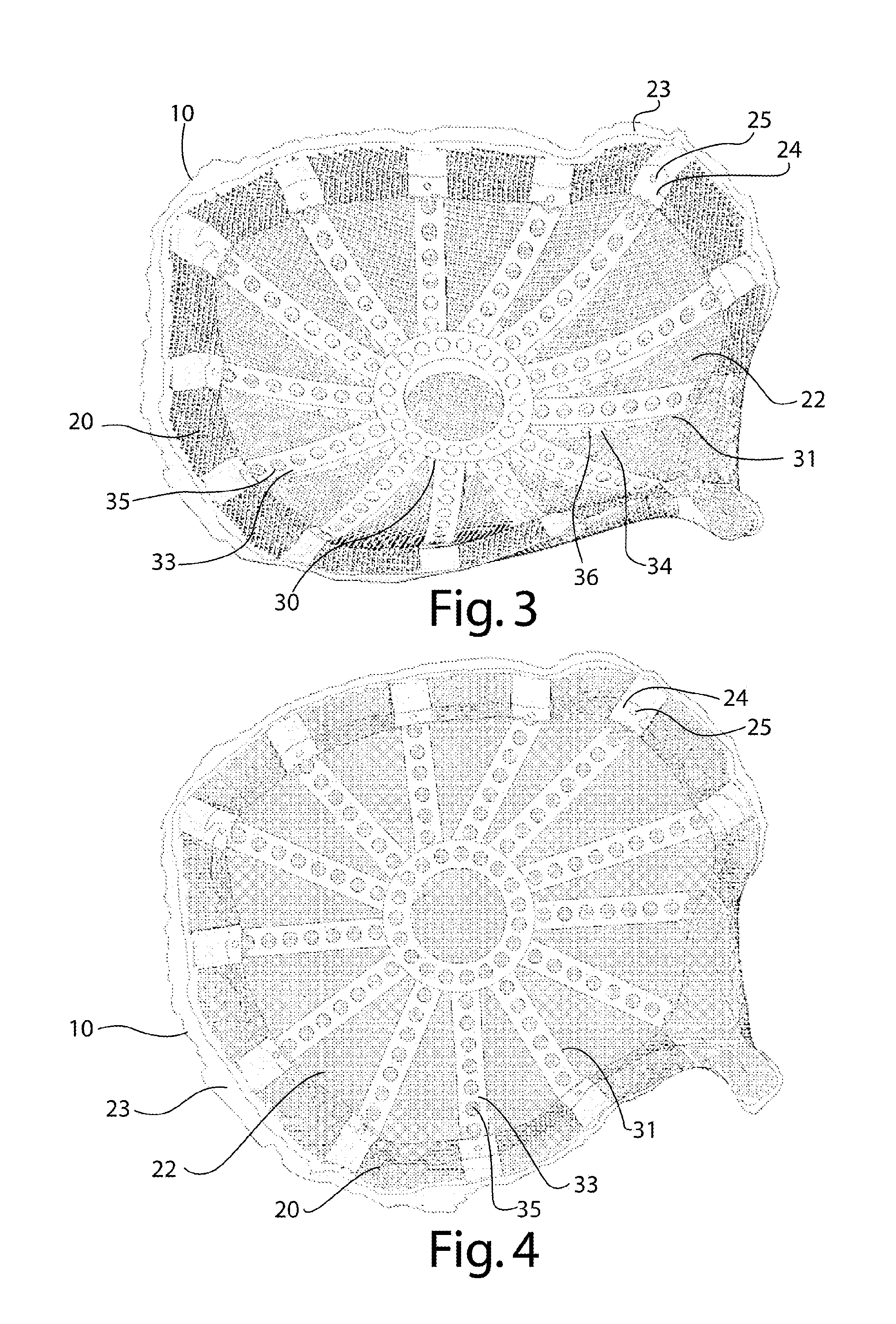 Reinforced biocompatible ceramic implant and manufacturing method thereof