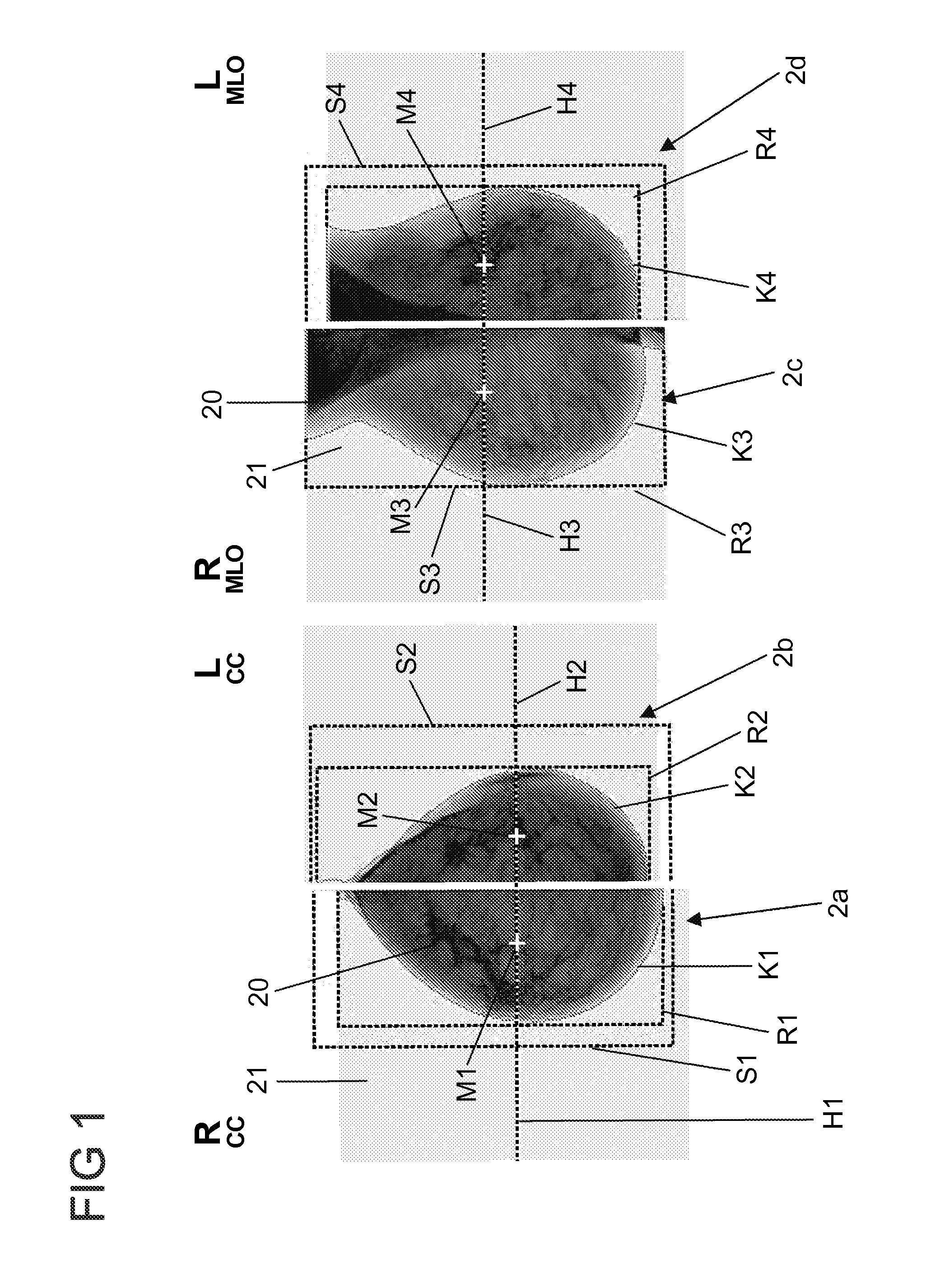 Method for processing findings entered in a mammogram