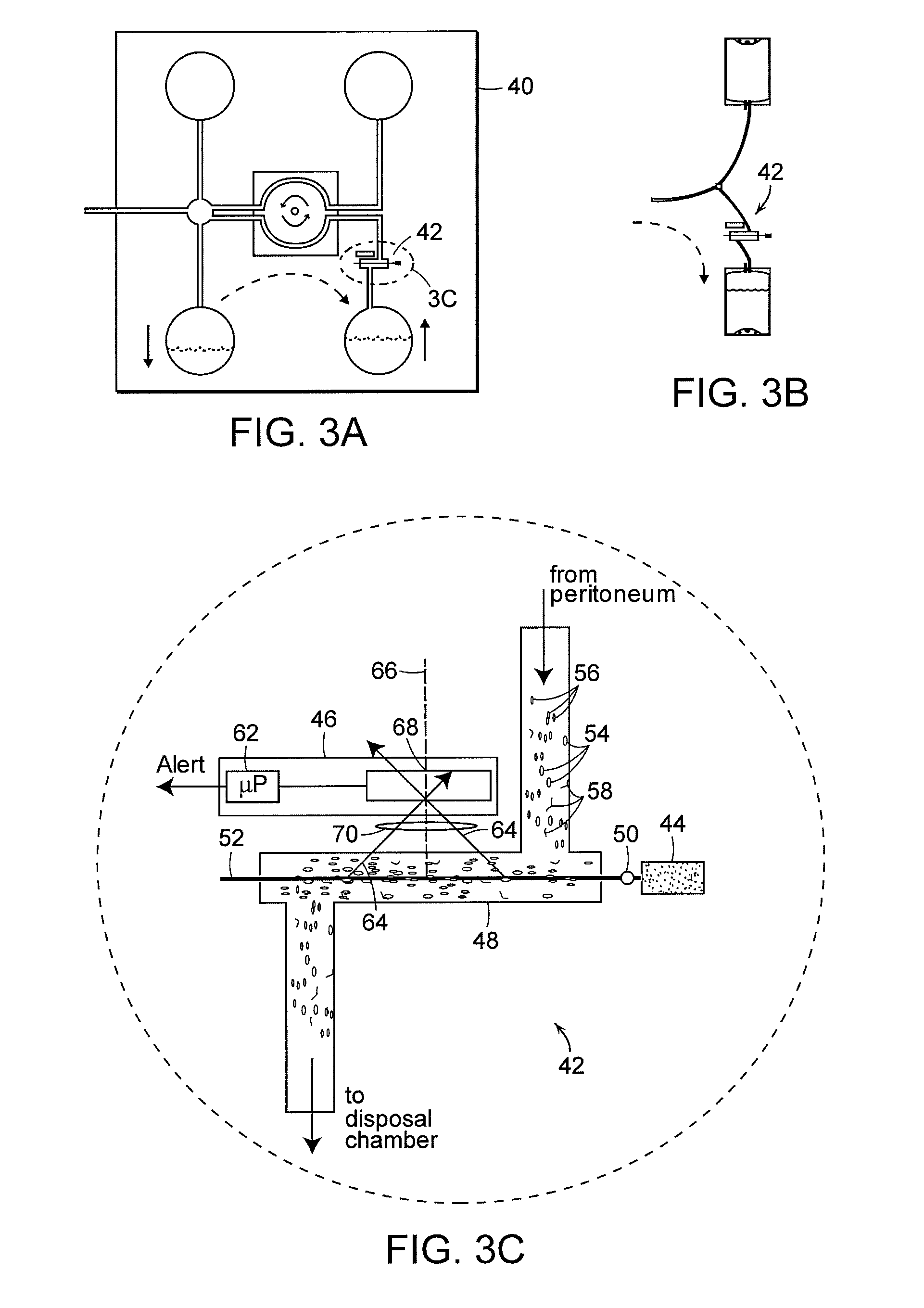 Apparatus and methods for early stage peritonitis detection and for in vivo testing of bodily fluid