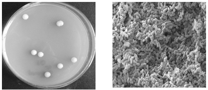 Acinetobacter with authigenic nitrogen fixation capacity and application thereof