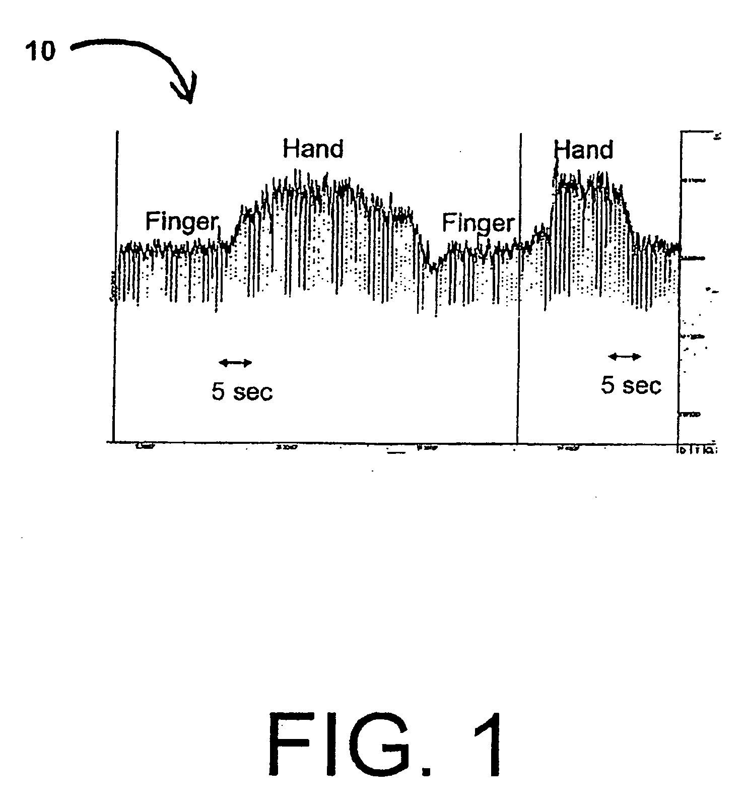 Systems and methods for epicardial navigation