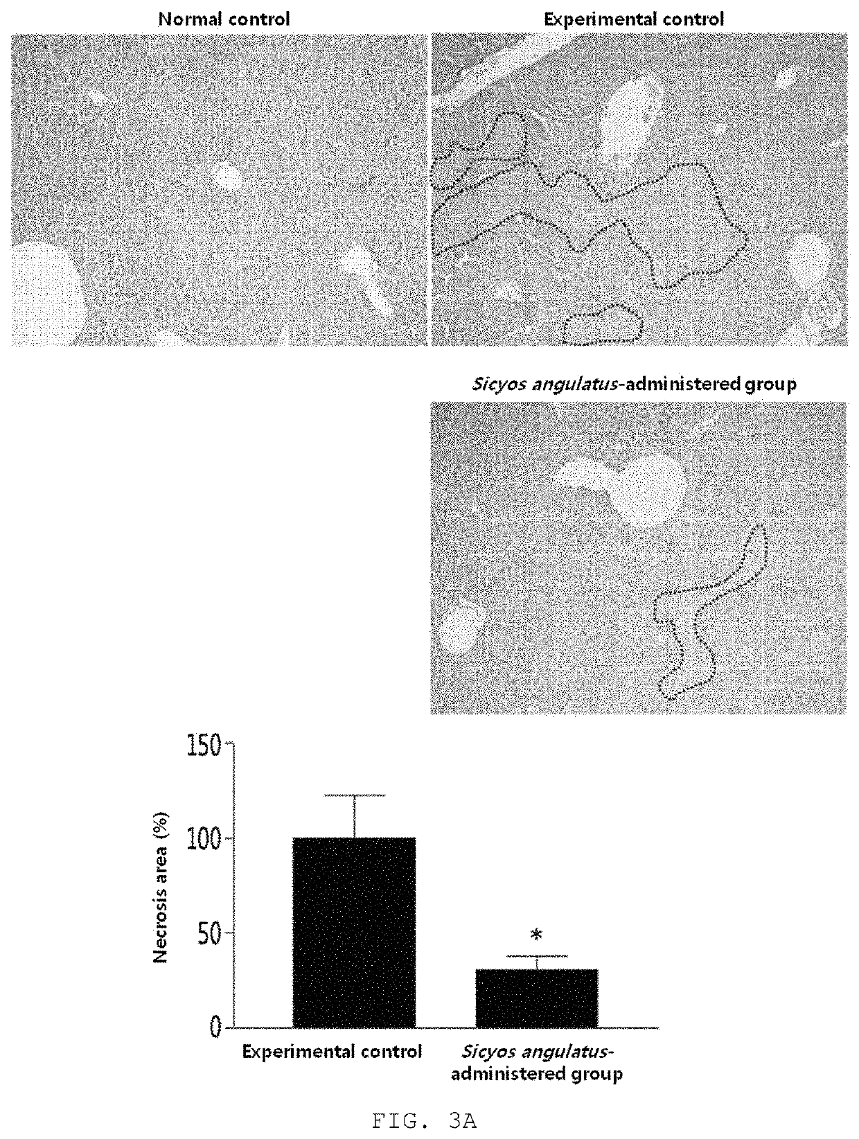 Composition for treating or preventing liver diseases, containing sicyos angulatus extract as active ingredient