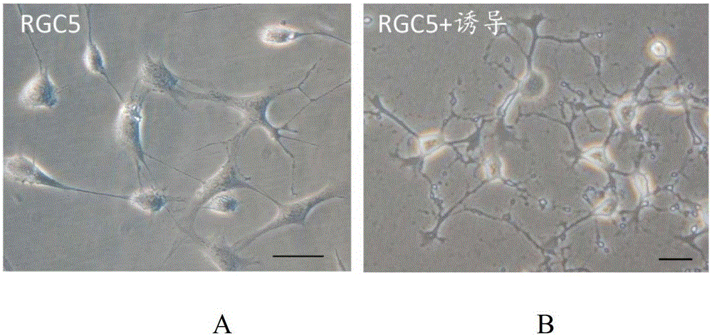 A lentivirus carrying neuritin gene and its application in repairing optic nerve damage