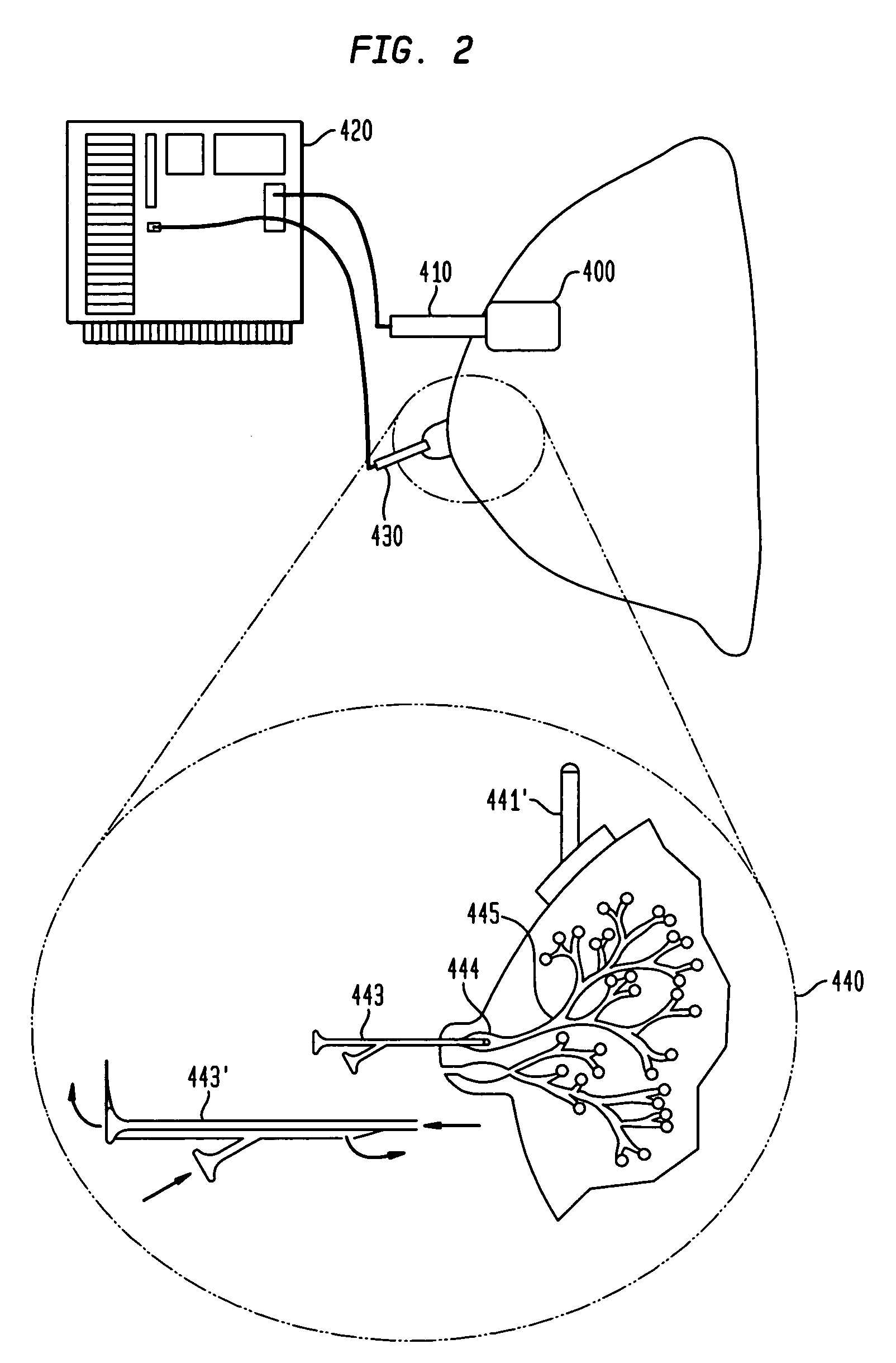Method and system for detecting electrophysiological changes in pre-cancerous and cancerous breast tissue and epithelium