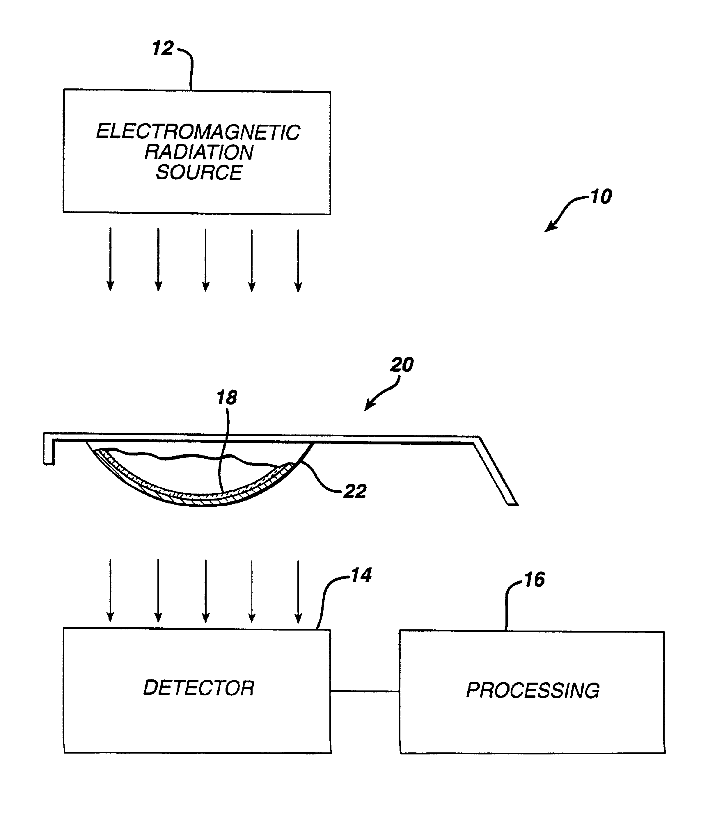 Missing lens detection system and method