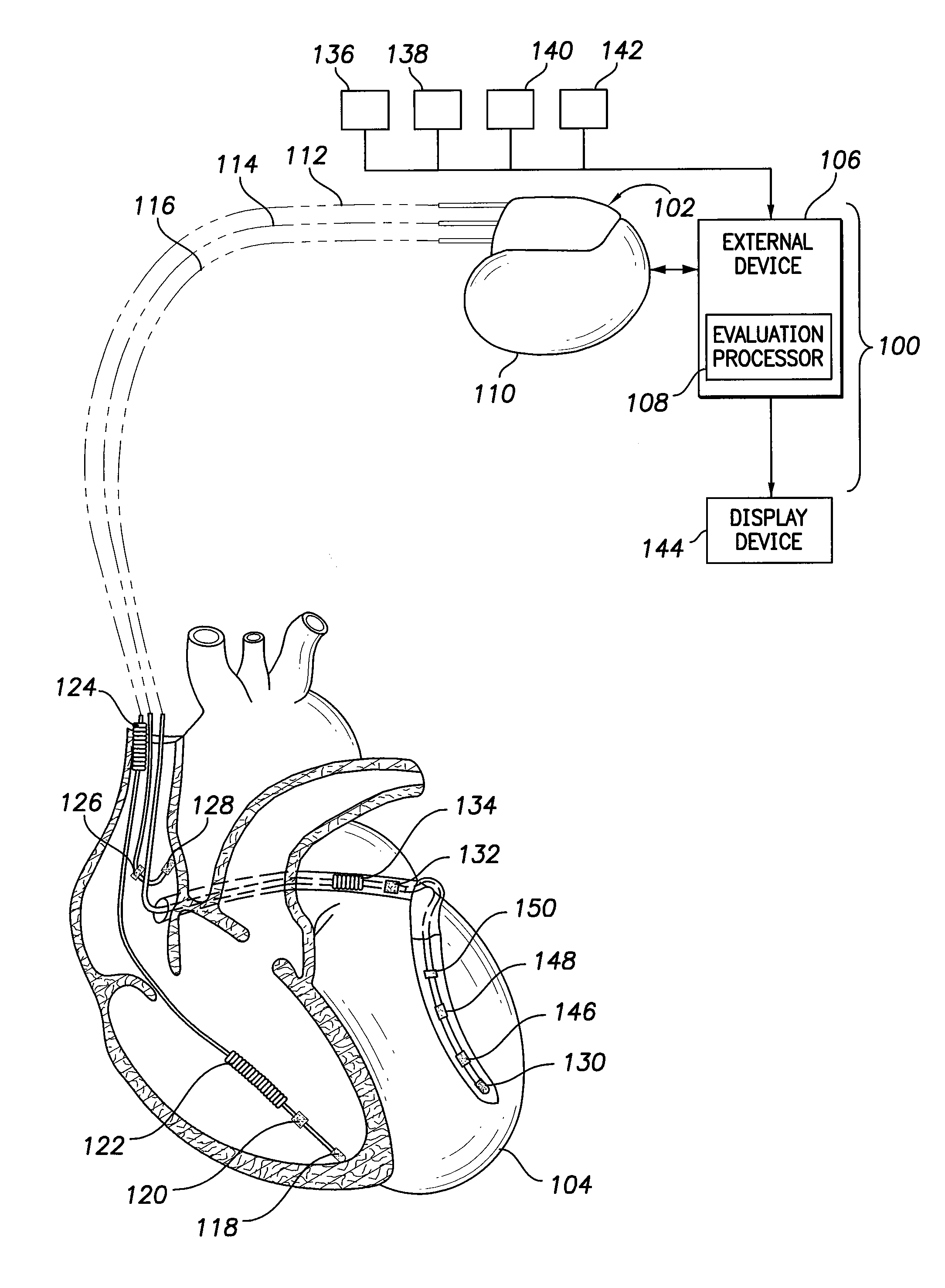 Cardiac analysis system for comparing clinical and induced ventricular tachycardia events