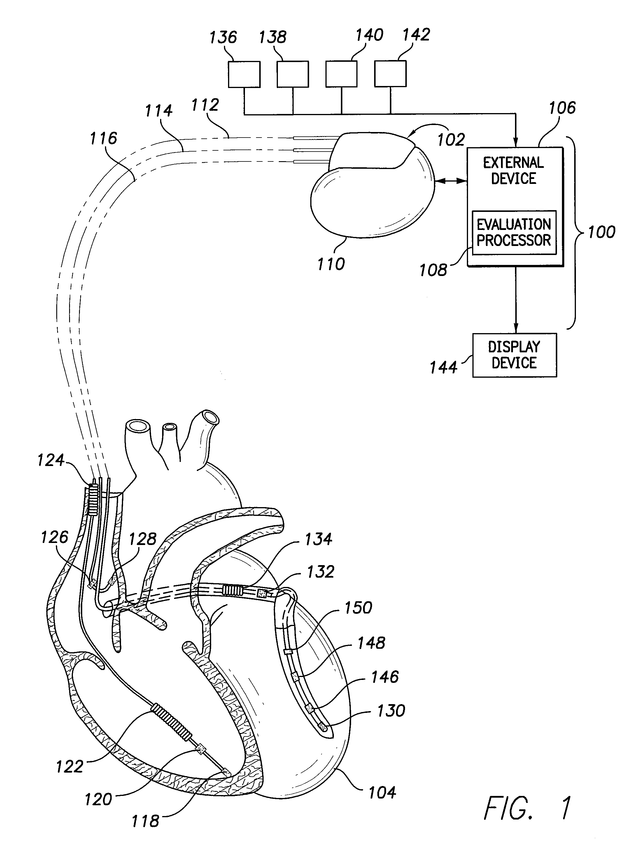 Cardiac analysis system for comparing clinical and induced ventricular tachycardia events