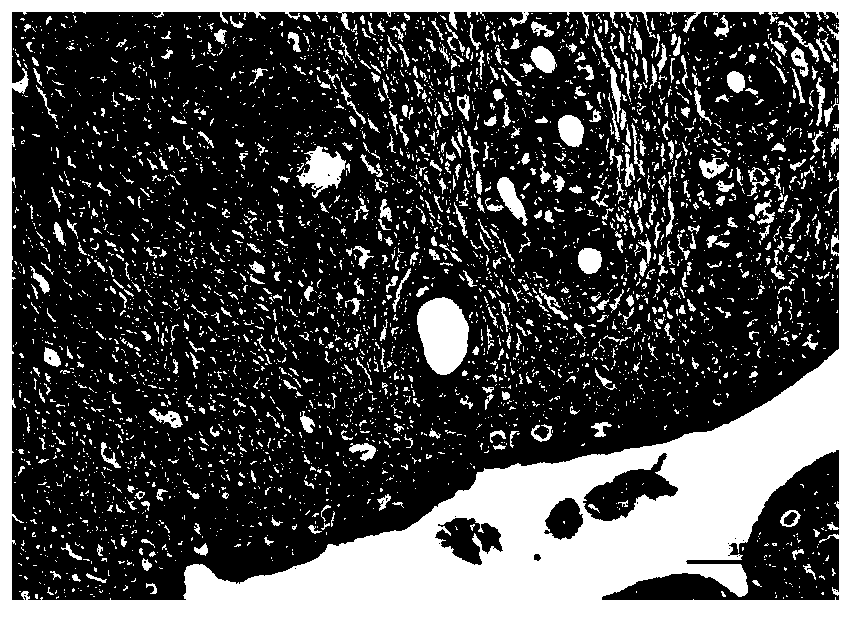 Curcumin piperine preparation, and preparation method and application thereof