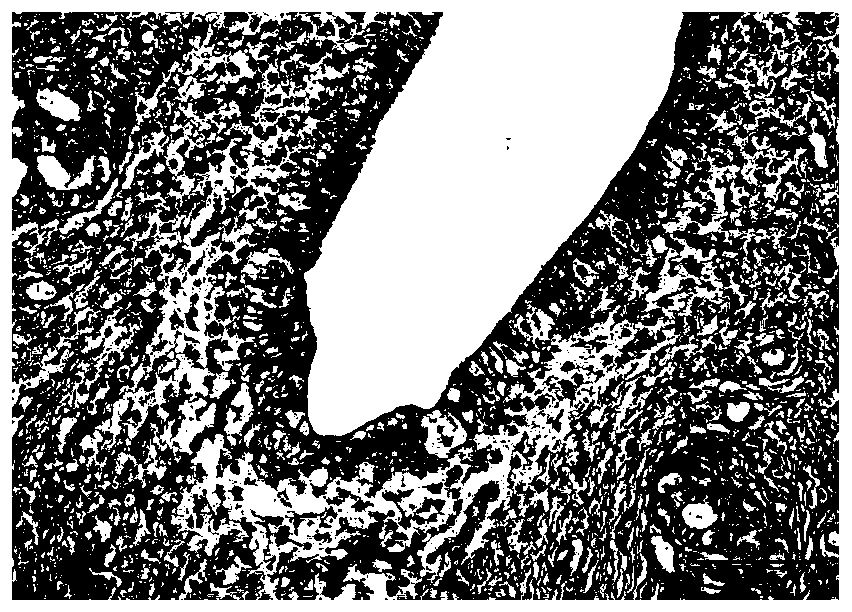 Curcumin piperine preparation, and preparation method and application thereof