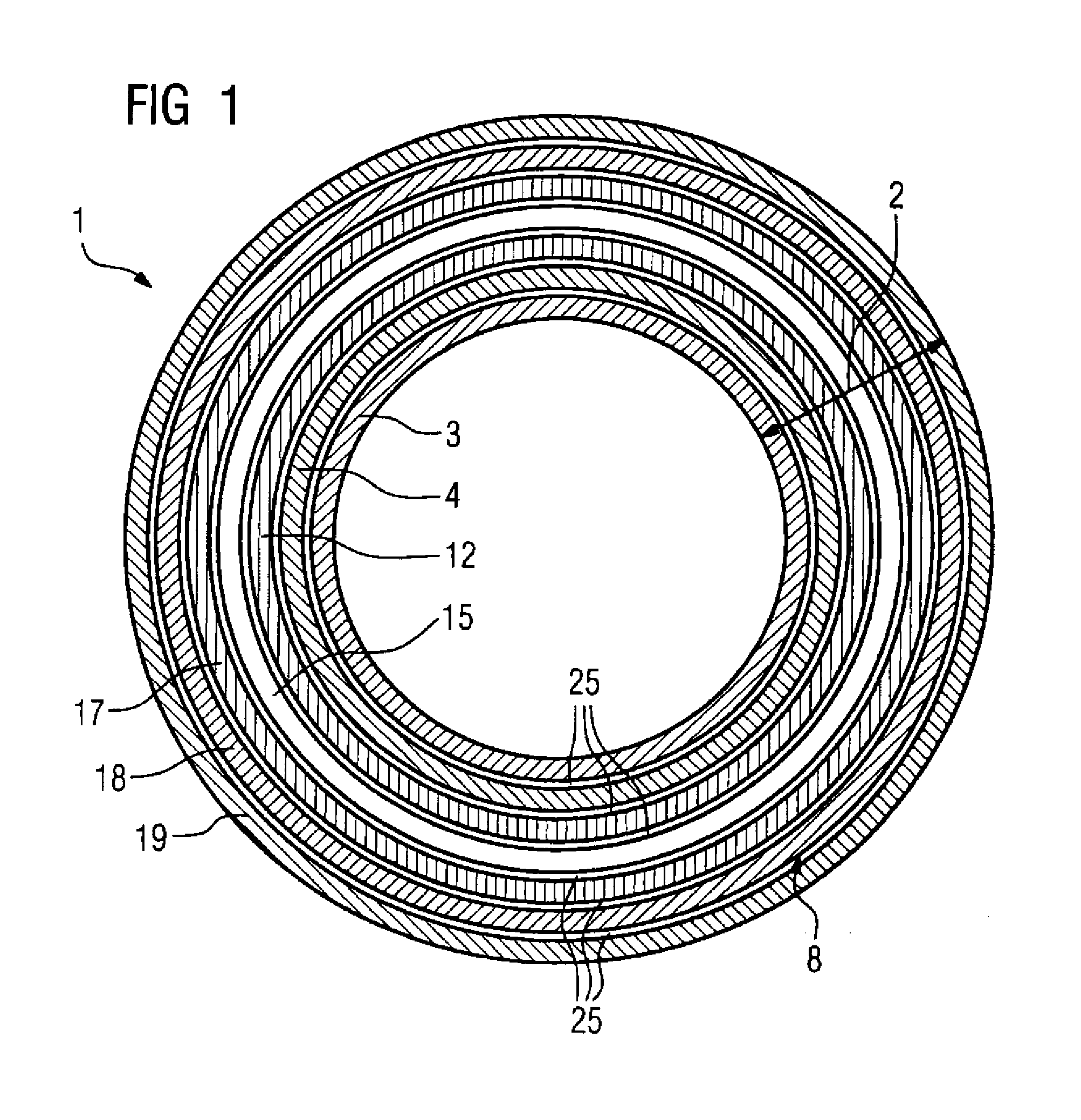 Gradient coil system and MR imaging system embodying same