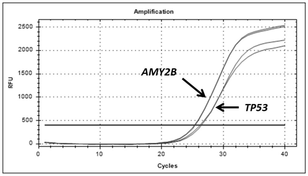 PCR amplification primer and probe for detecting AMY2B gene copy number and application of PCR amplification primer and probe
