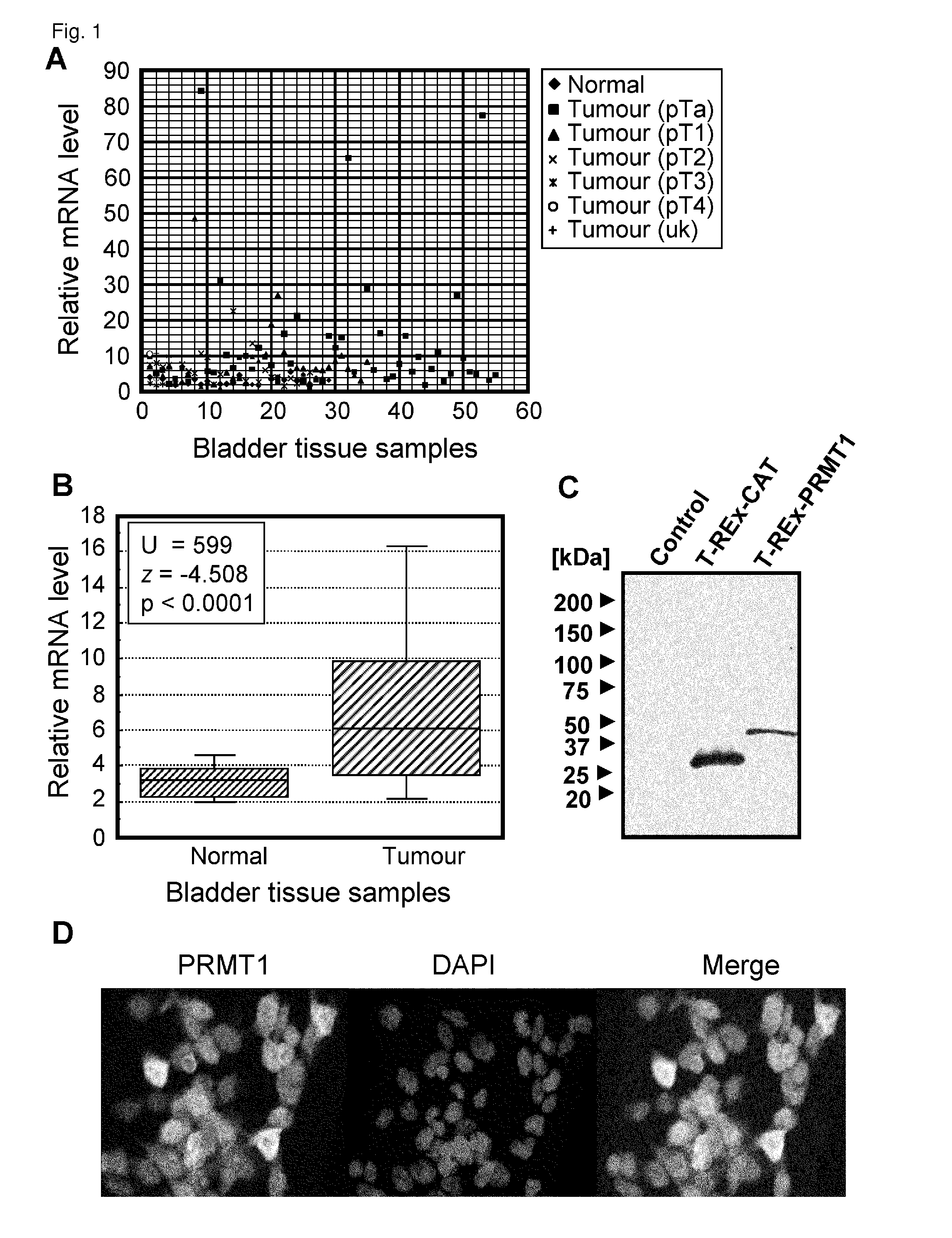 PRMT1 for target genes of cancer therapy and diagnosis