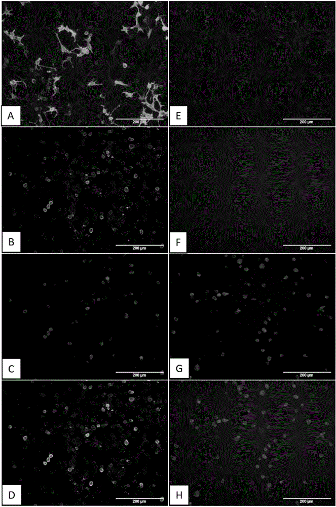 Cell immobilization technology and AQP4 antibody detection kit prepared through same