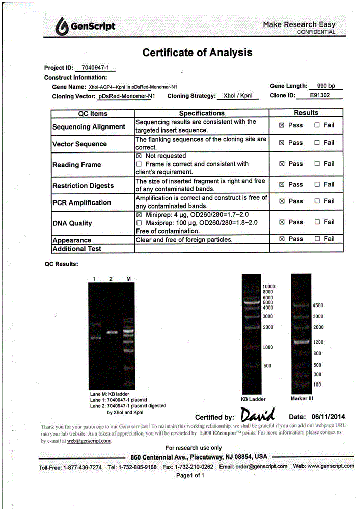 Cell immobilization technology and AQP4 antibody detection kit prepared through same