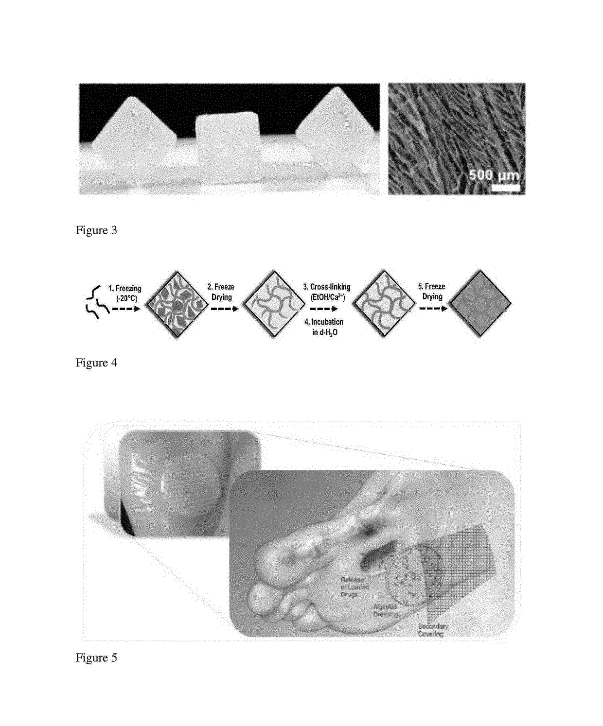 Prefabricated alginate-drug bandages