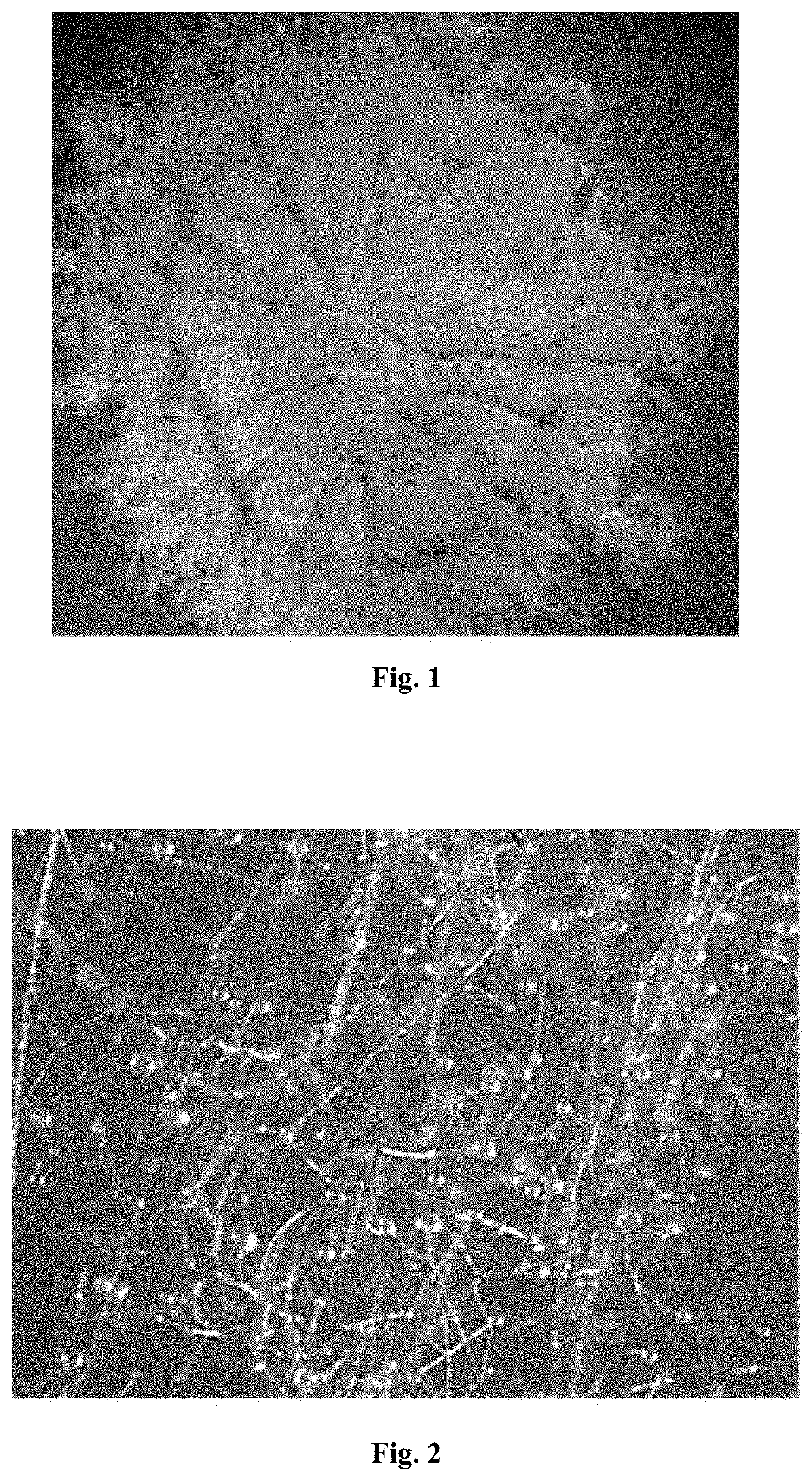 High esters producing strain of monascus purpureus and its application in production of ester flavor monascus fermented cheese