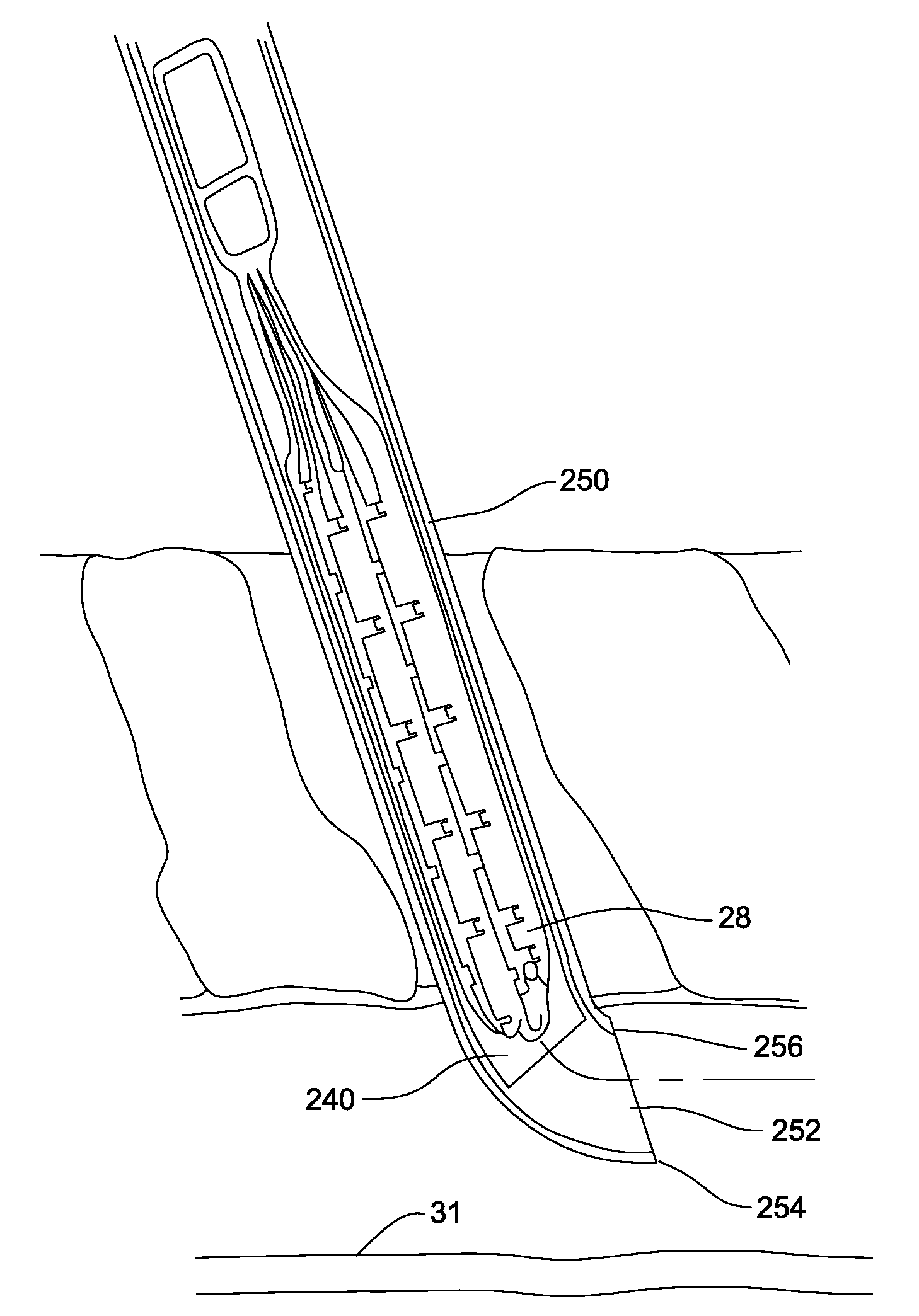 Foldable, implantable electrode assembly and tool for implanting same