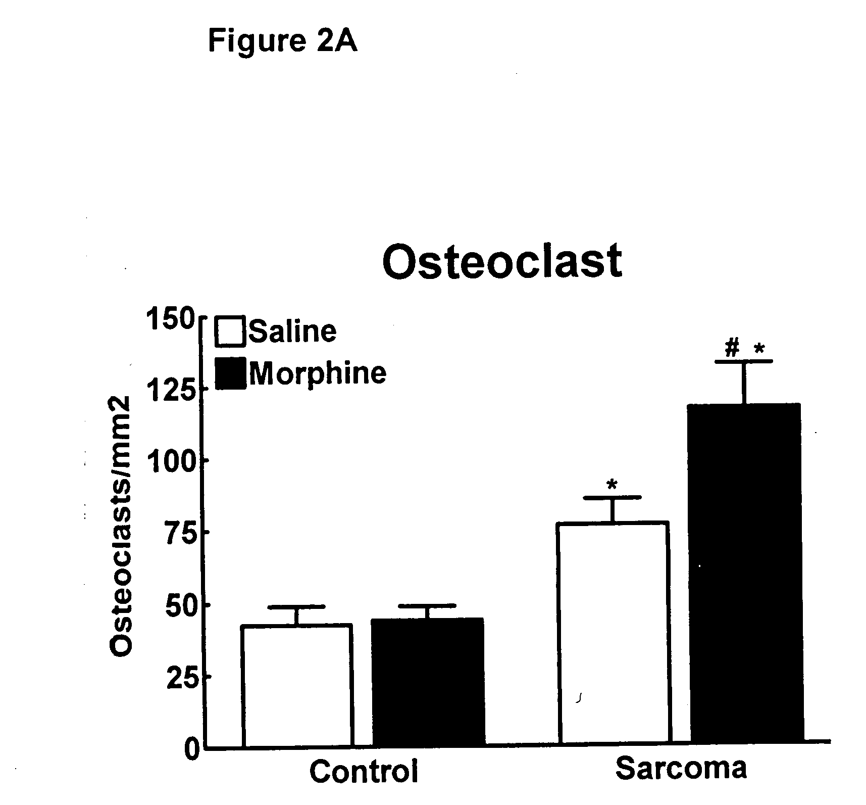 Compositions and methods in the treatment of bone metabolic disorders
