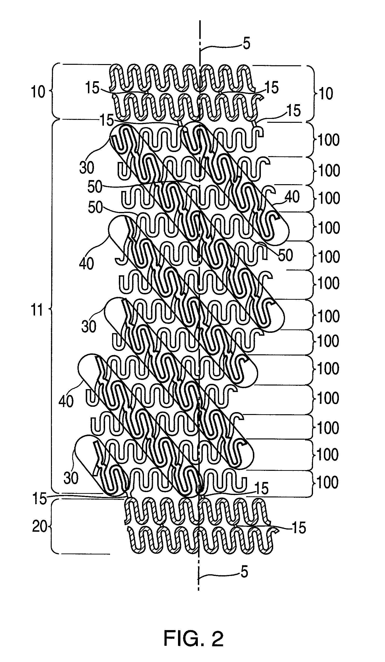 Stent having helical elements