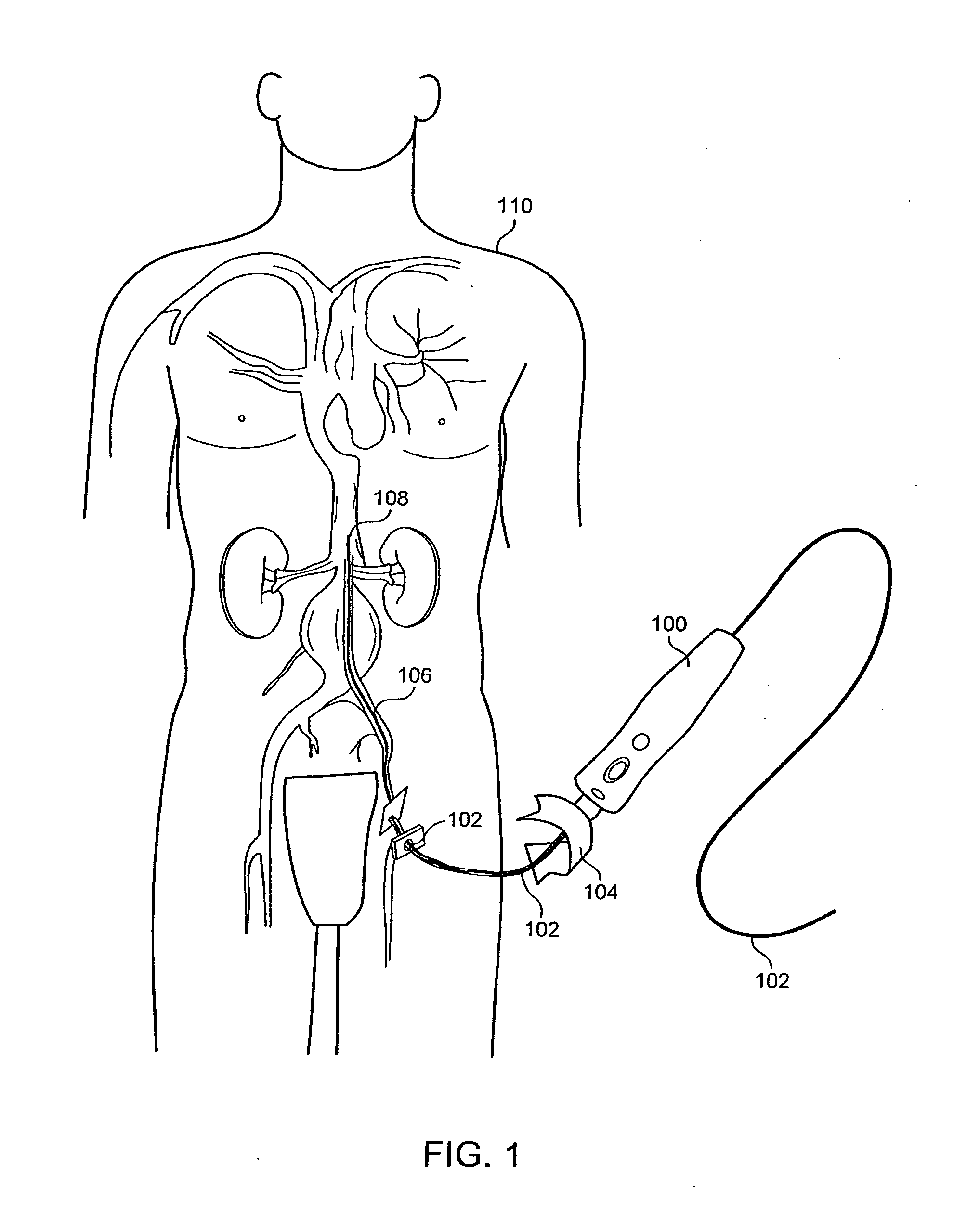 Method and apparatus for manipulating a surgical guidewire