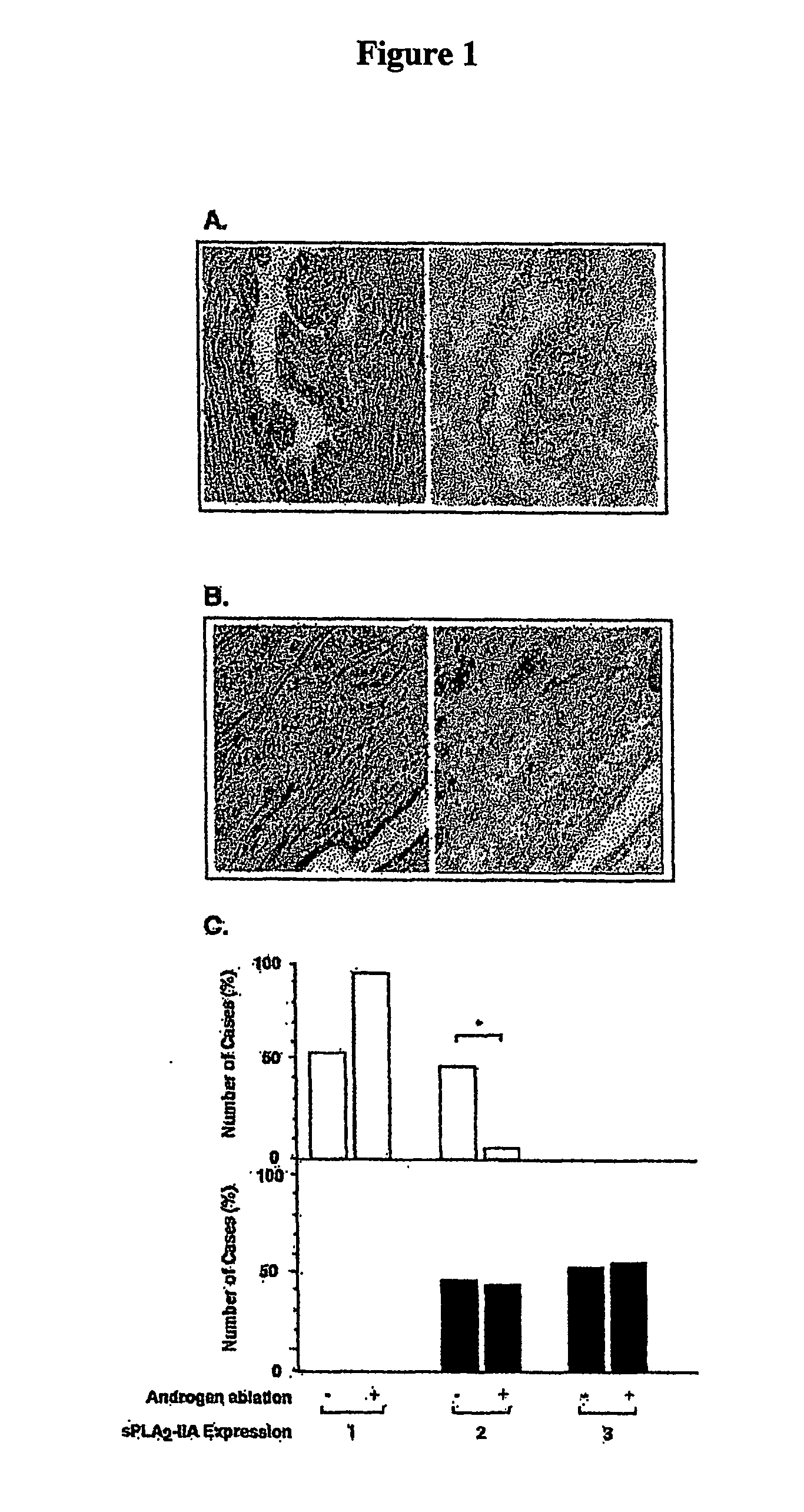 Method of Inhibiting Prostate Cancer Cell Proliferation
