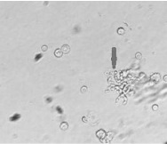 Protective solution containing combined antibiotics for dental pulp stem cell sampling