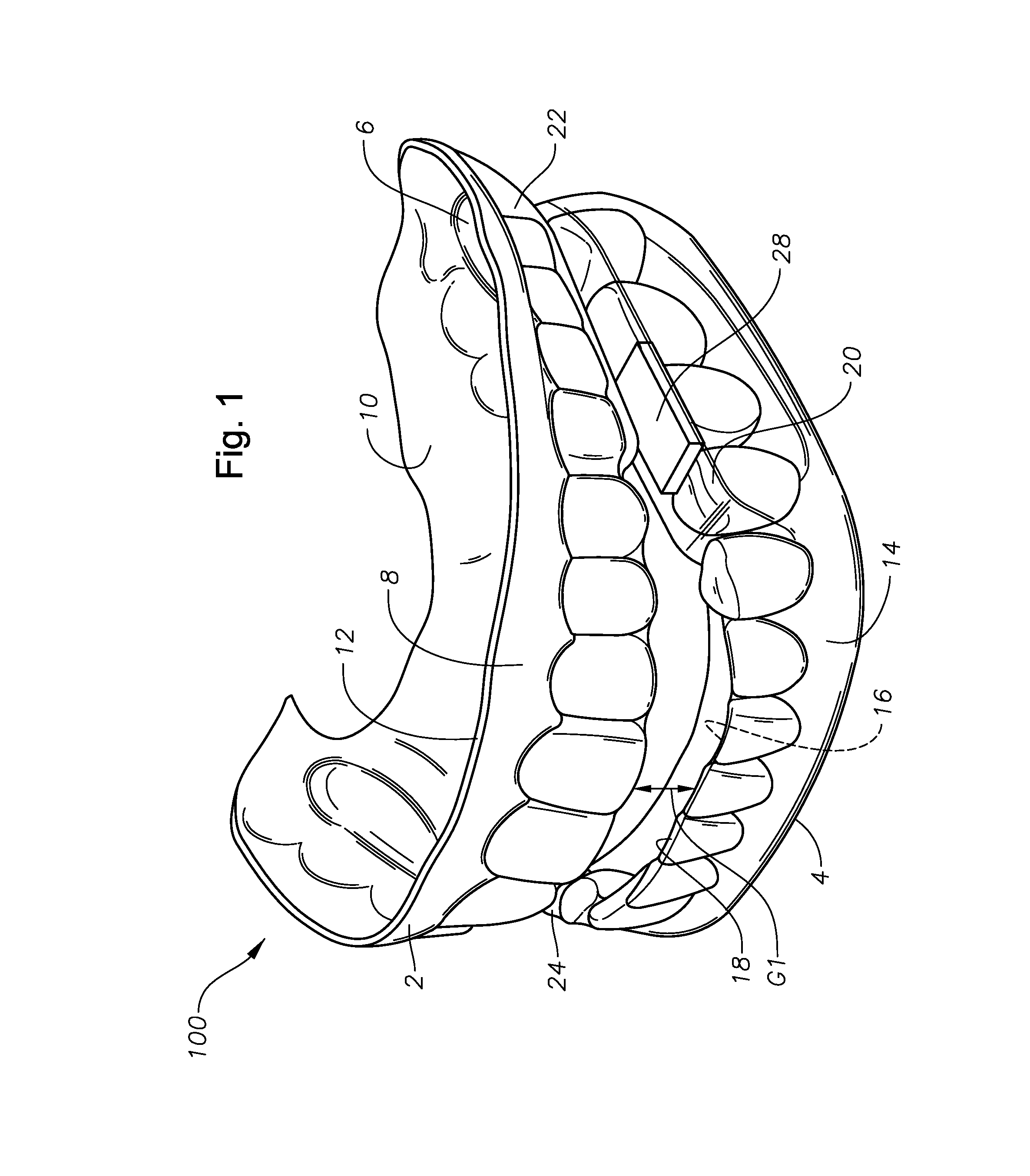 Oral devices, kits, and methods for reducing sleep apnea, snoring, and/or nasal drainage