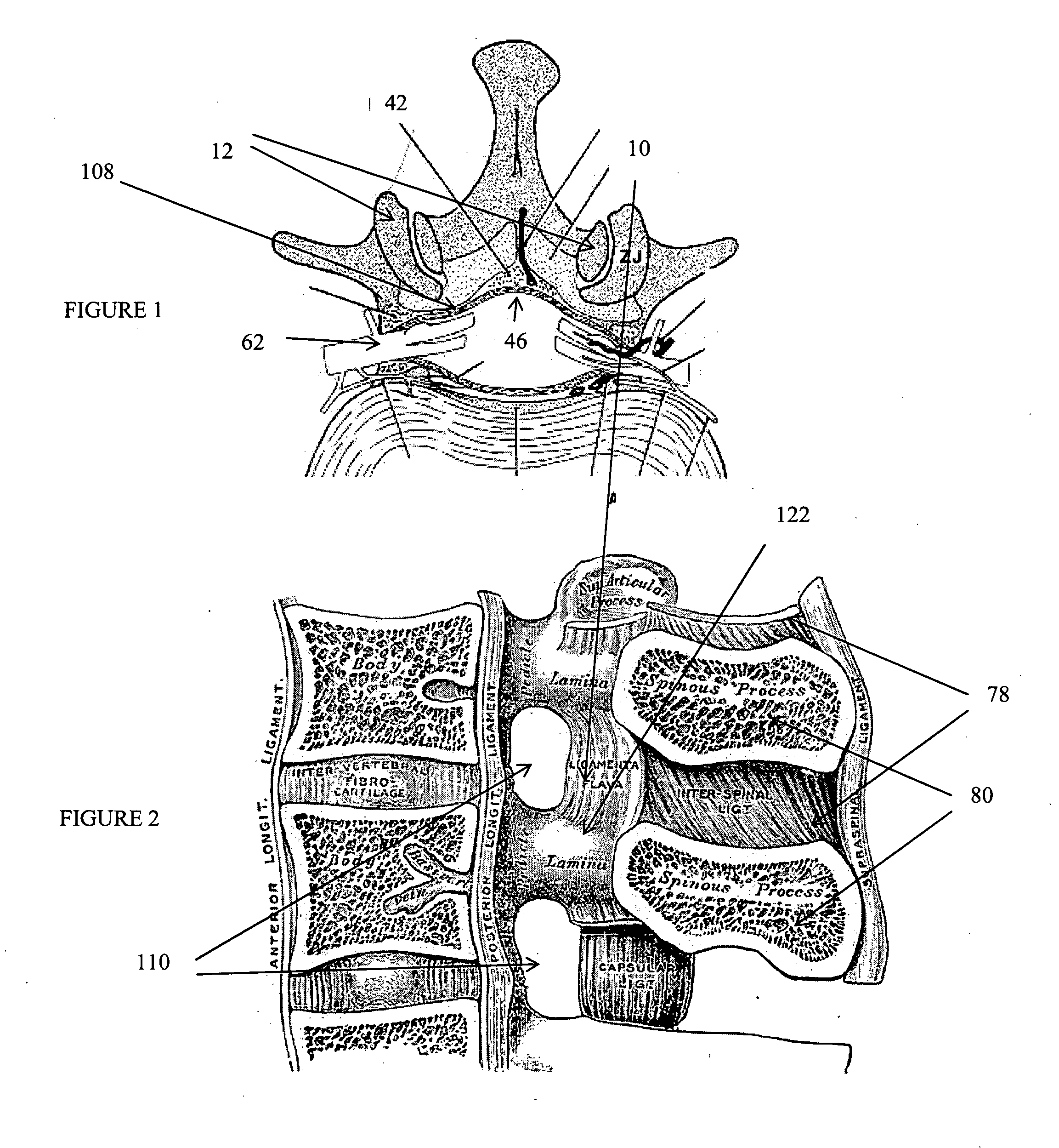 Devices and methods for tissue access