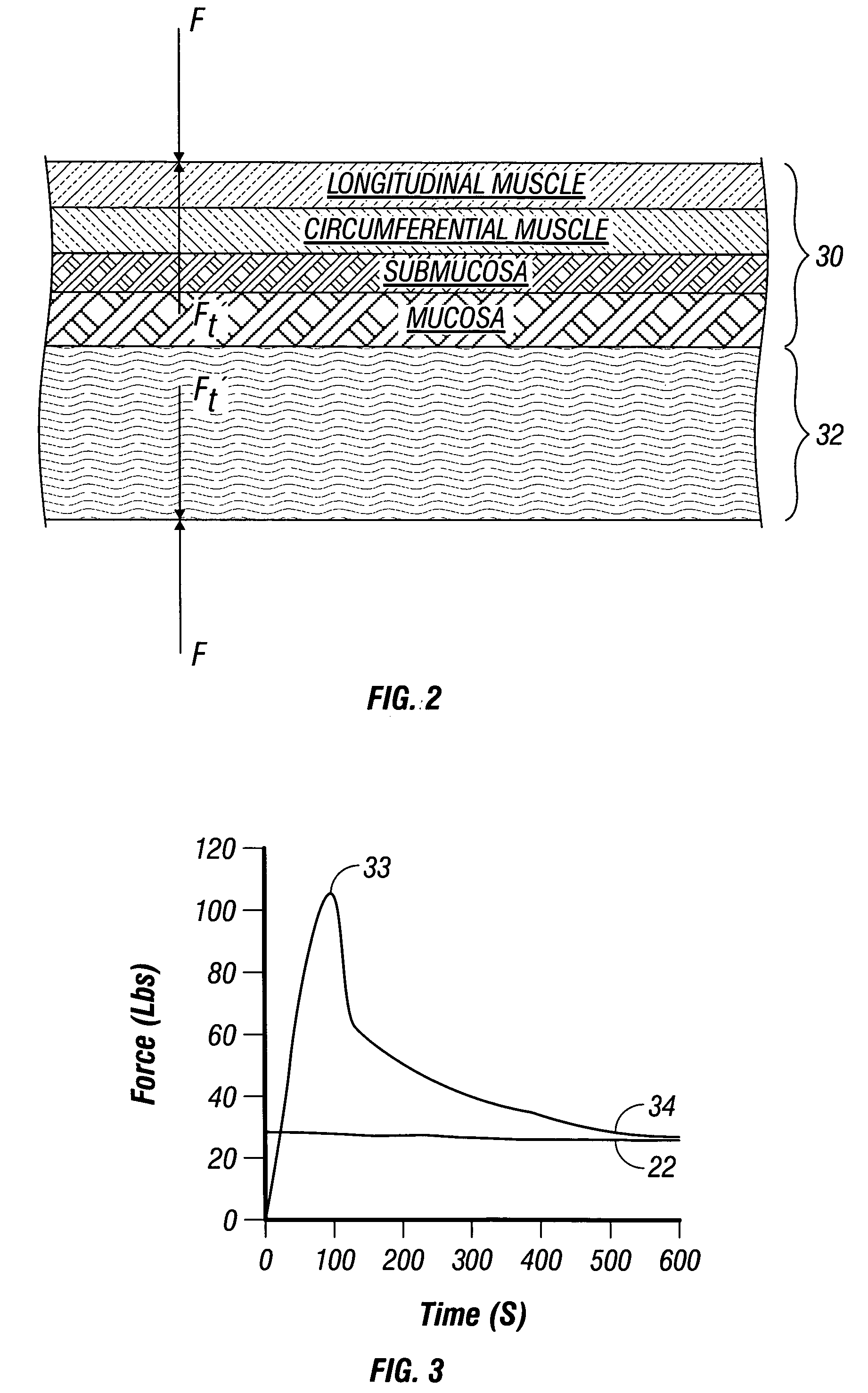 Method and system to determine an optimal tissue compression time to implant a surgical element