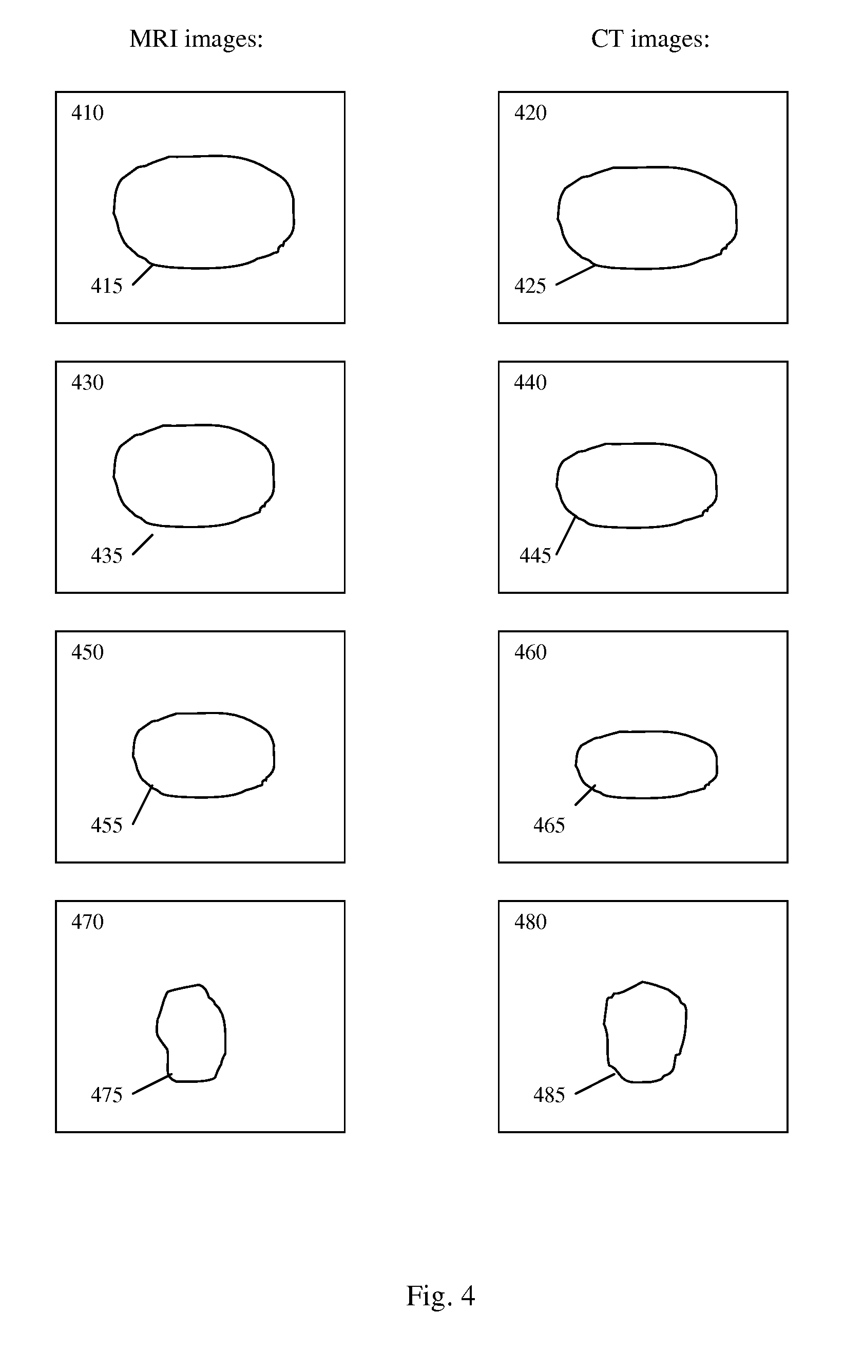 Method and system for processing medical image datasets