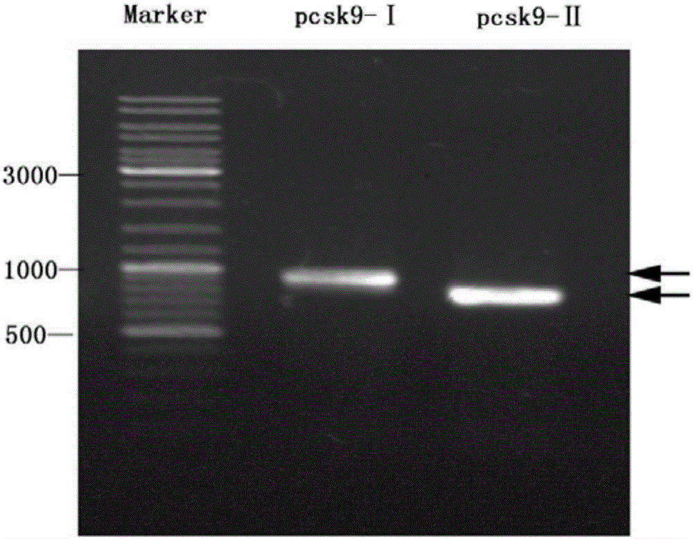 Anti-hyperlipidemia protein vaccine aiming at PCSK9 (Proprotein convertase subtilisin/kexin type 9)