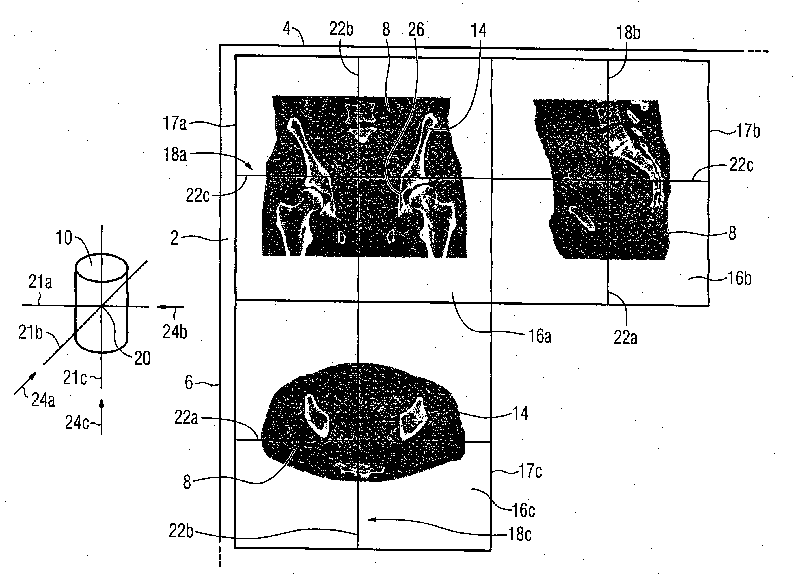 Method for display of medical 3D image data on a monitor