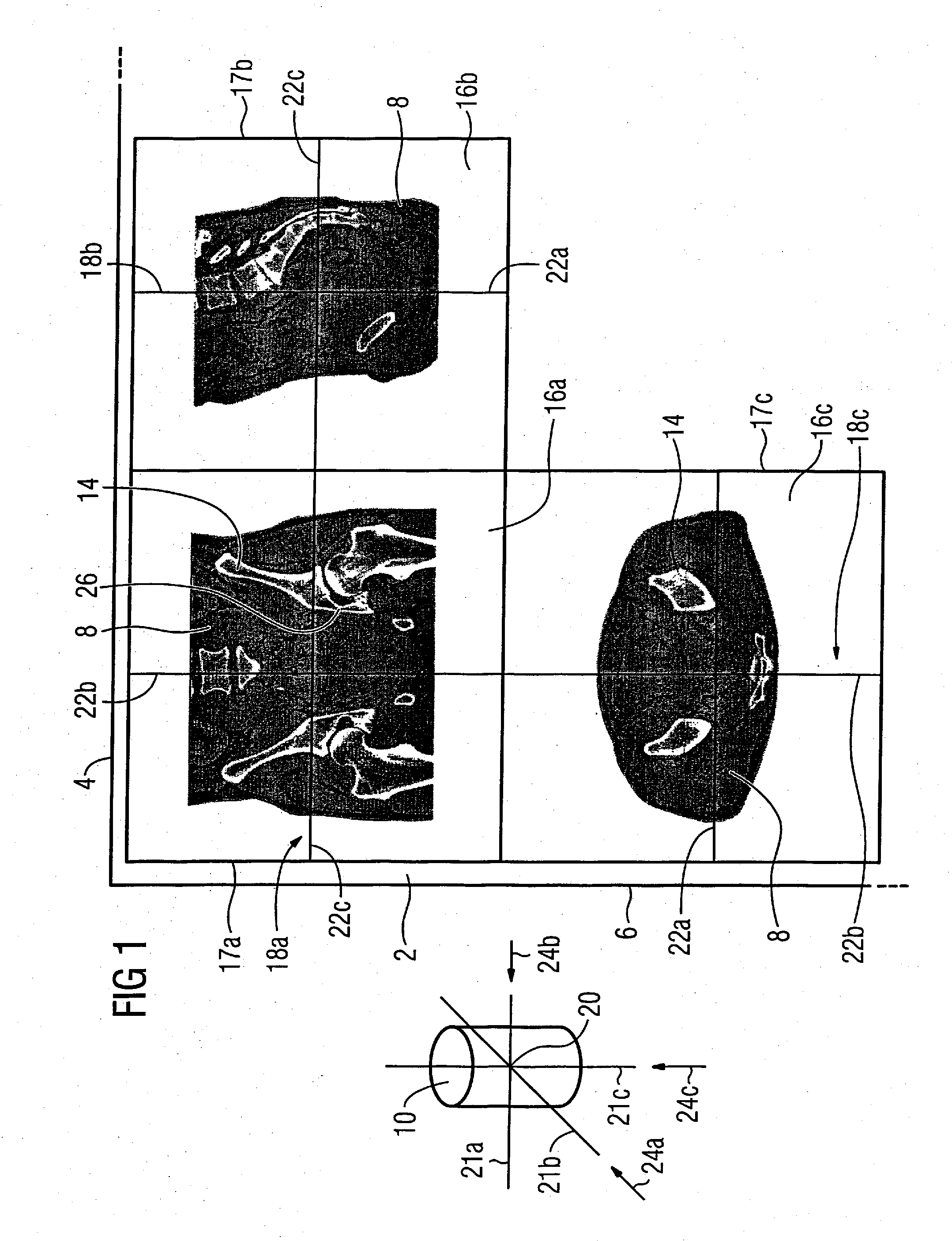 Method for display of medical 3D image data on a monitor
