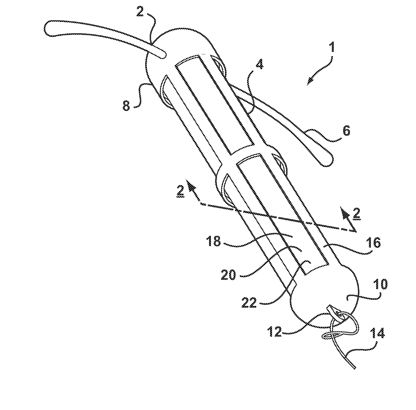 Intrauterine deposit