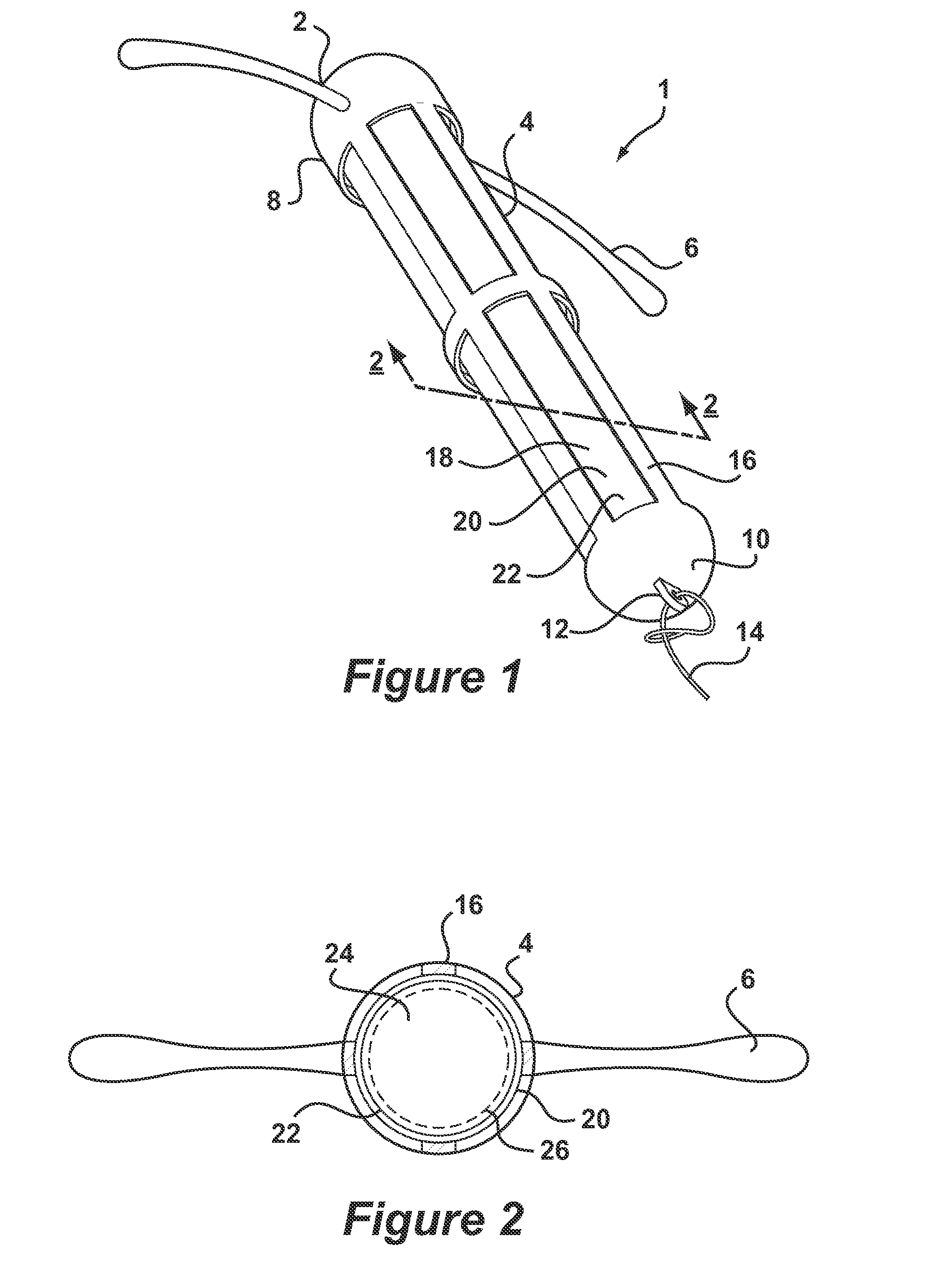 Intrauterine deposit