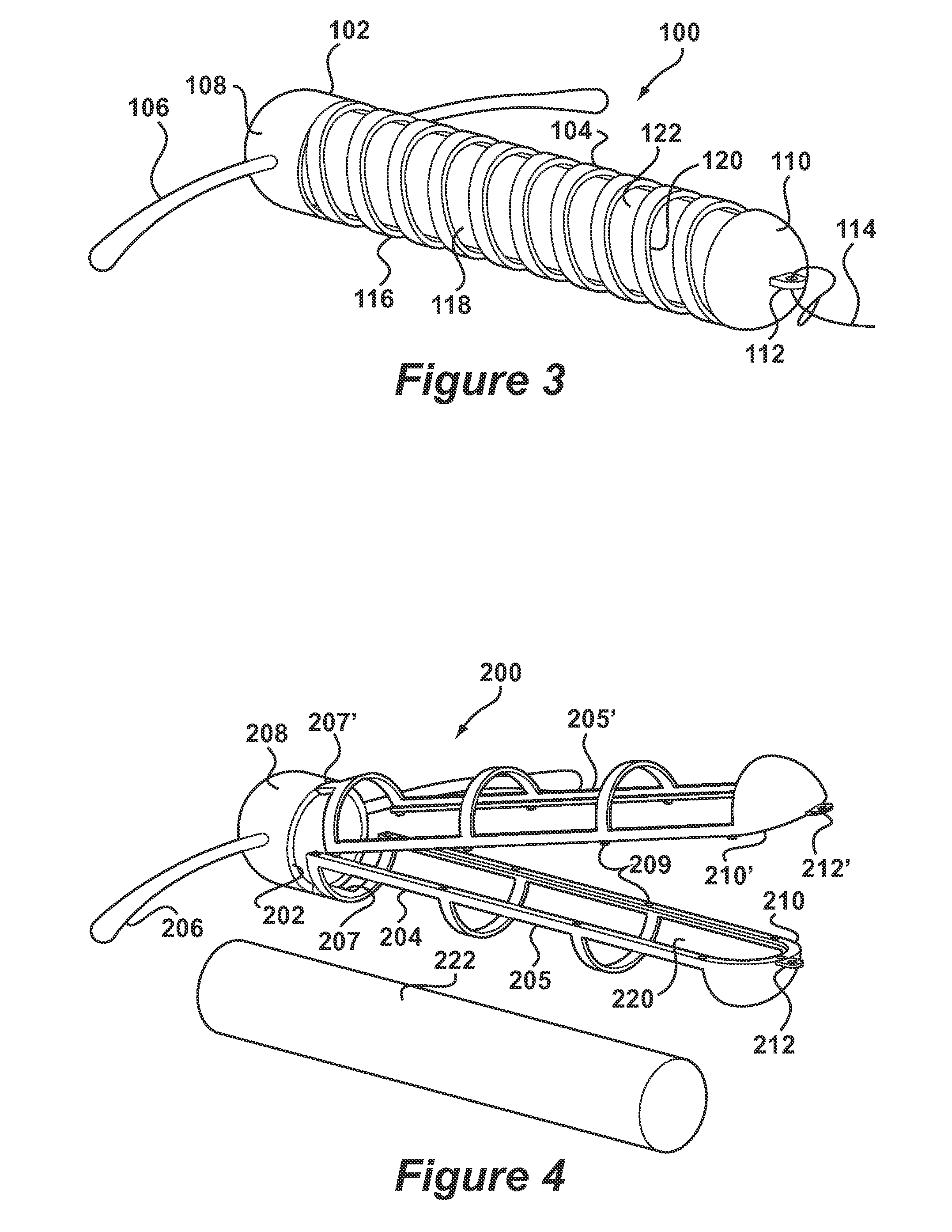 Intrauterine deposit