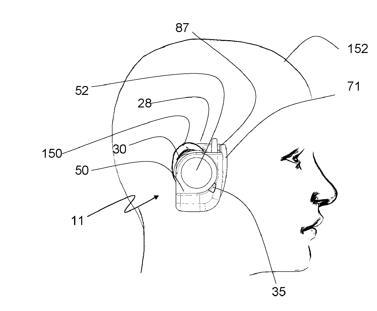 Spectator broadcast system with an ear mounted receiver