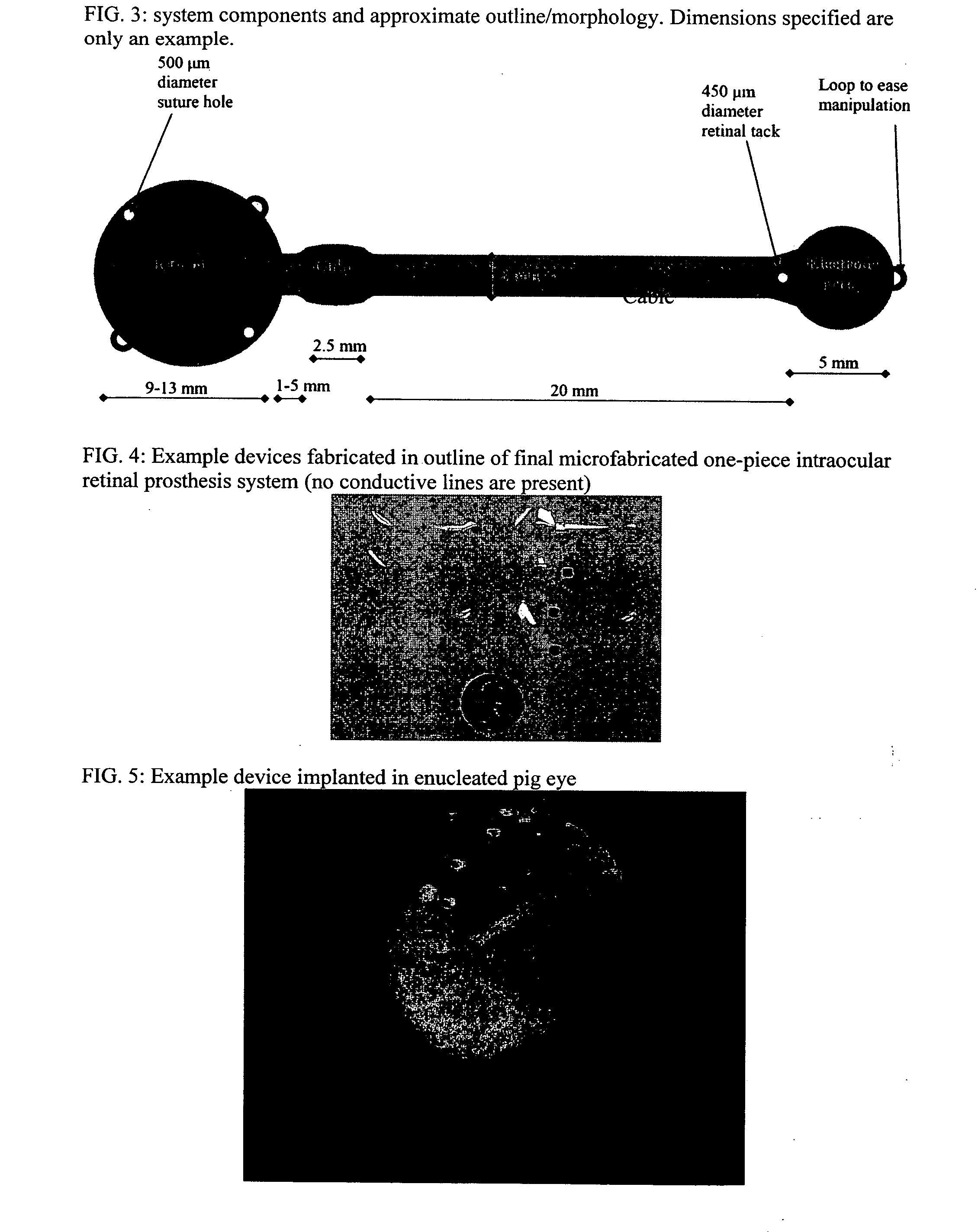 Batch-fabricated flexible intraocular retinal prosthesis system and method for manufacturing the same