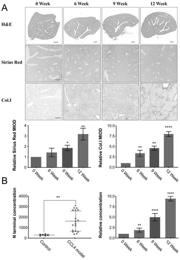 Application of N-terminal DDR1 polypeptide