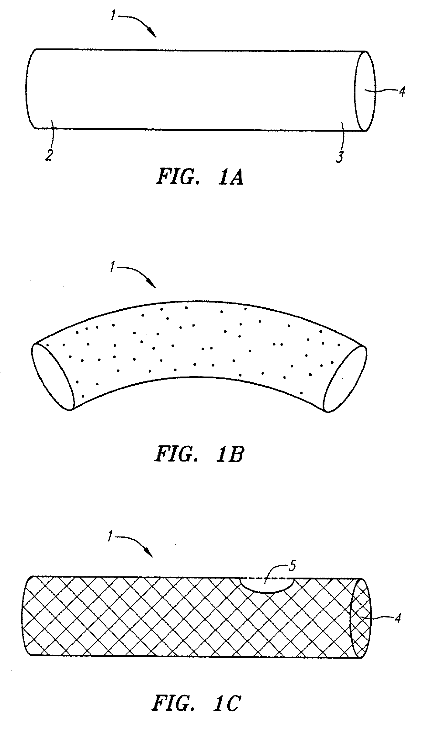 Methods and devices for treatging aortic atheroma