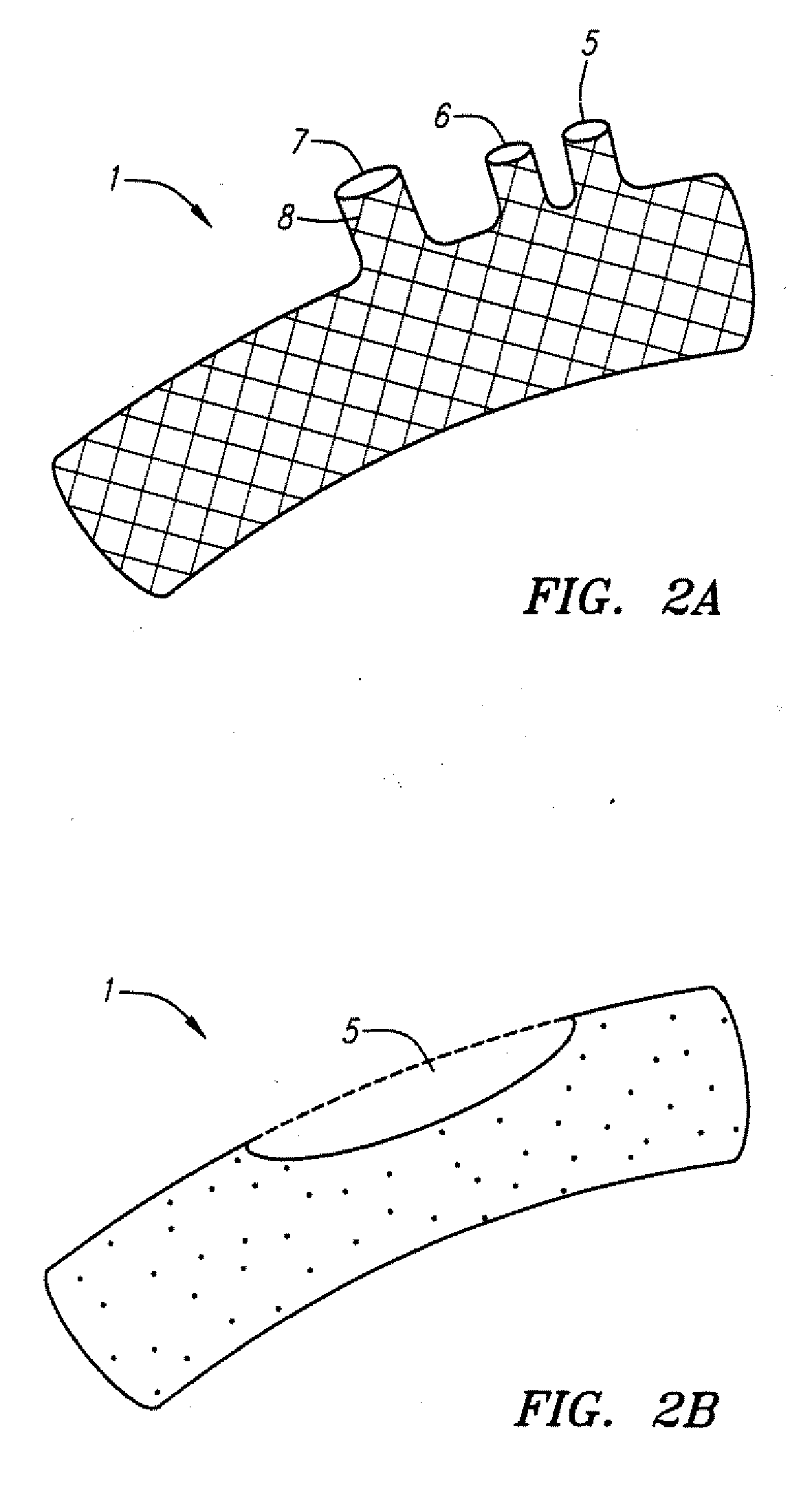 Methods and devices for treatging aortic atheroma