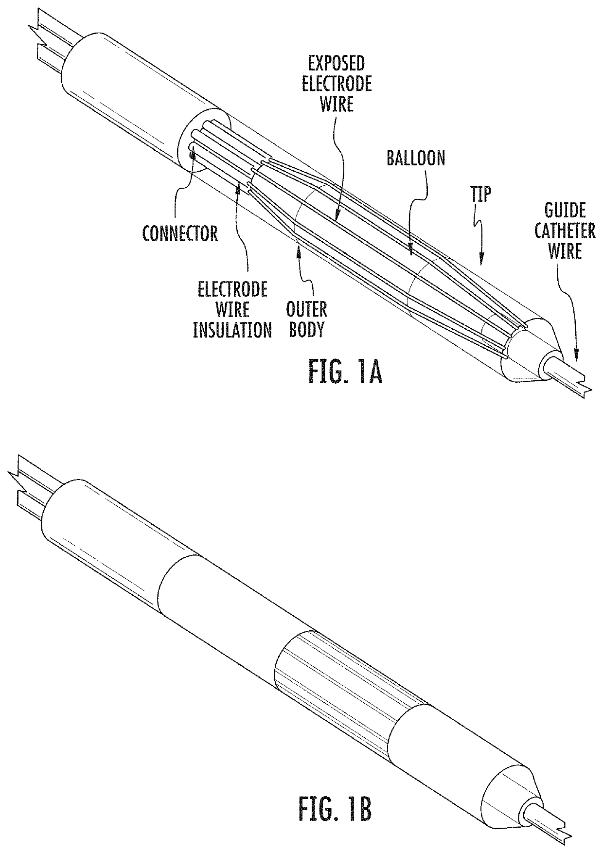 Device and method for electroporation based treatment of stenosis of a tubular body part