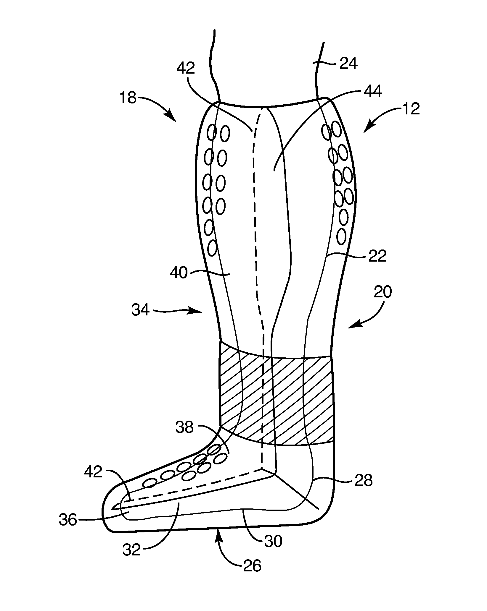 Total contact and offloading cast system