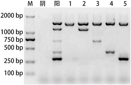 Kit for simultaneously detecting Vibrio parahaemolyticus, Escherichia coli O157:H7, Salmonella and Shigella